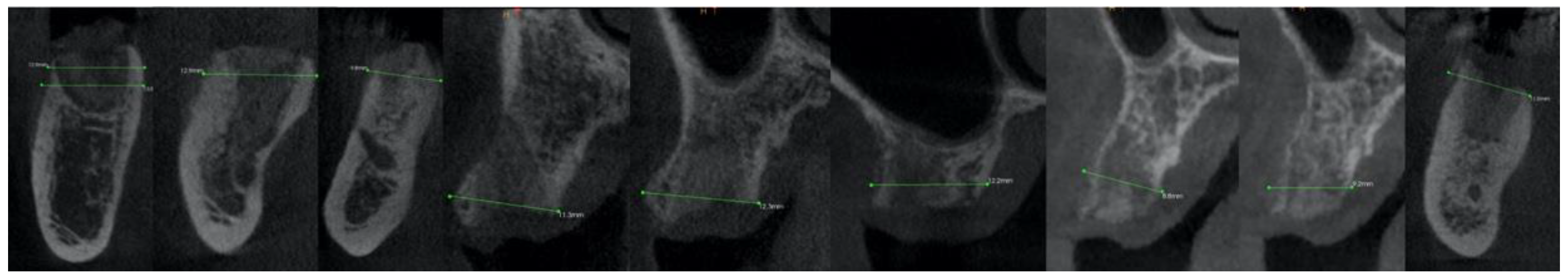 Applsci 12 12292 g006