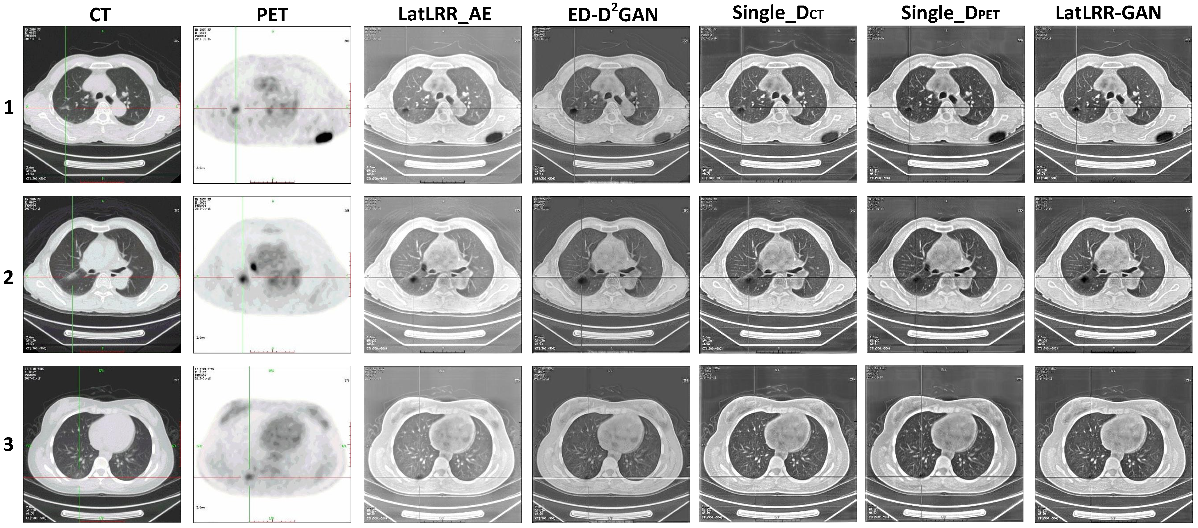 Applsci 12 12758 g007 Applsci 12 12758 g007