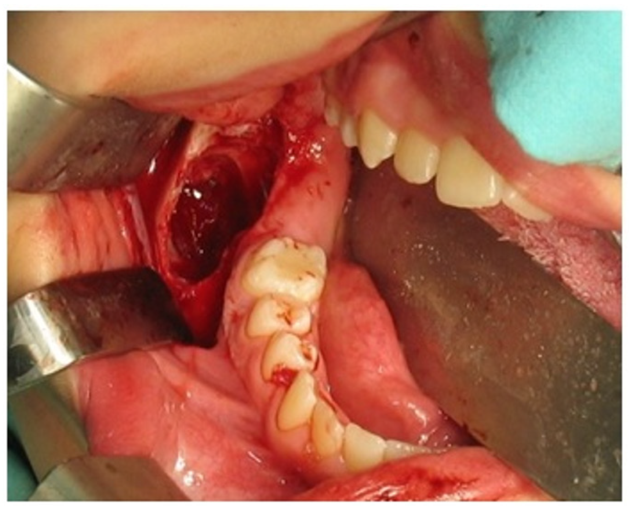 Applsci 12 12963 g005 Applsci 12 12963 g005