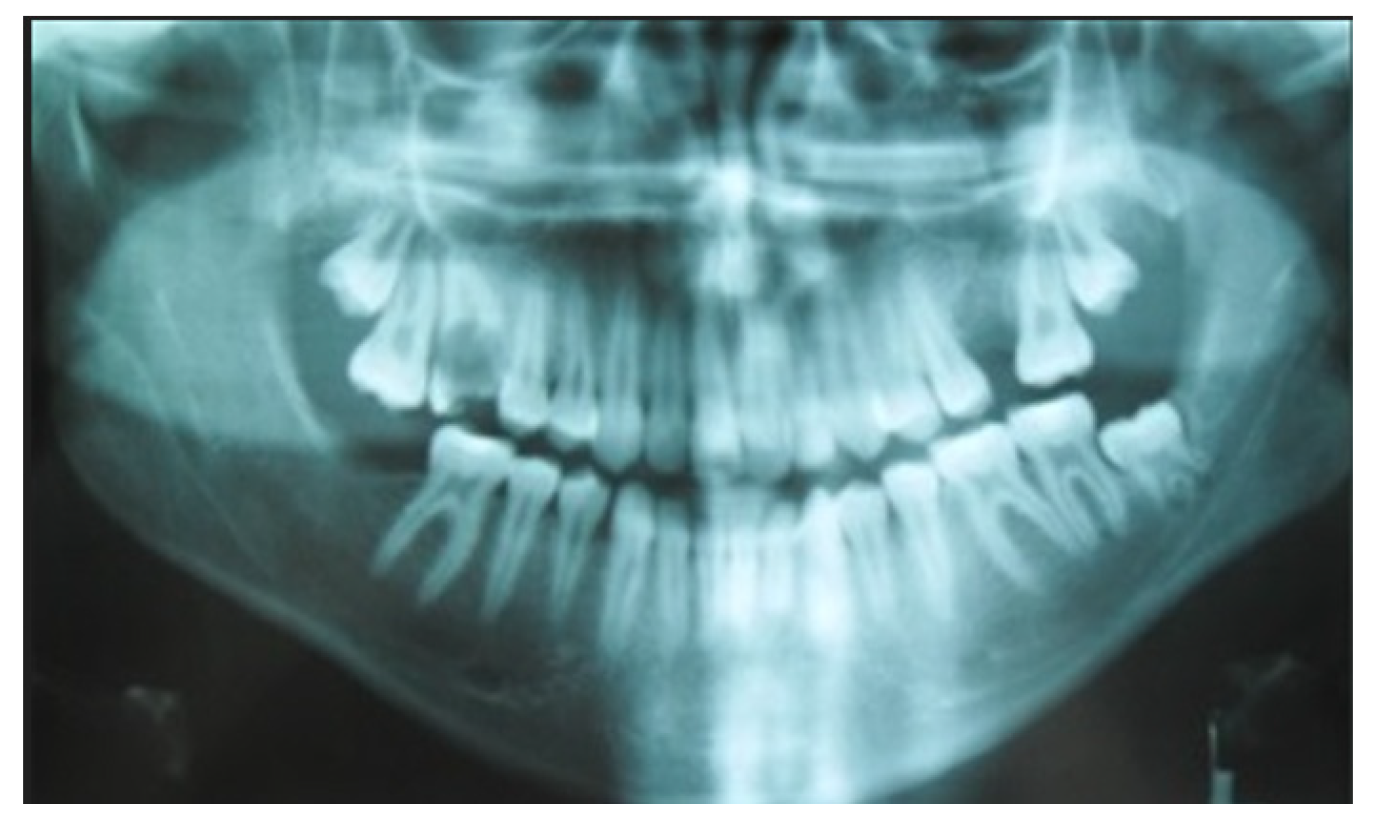 Applsci 12 12963 g008 Applsci 12 12963 g008