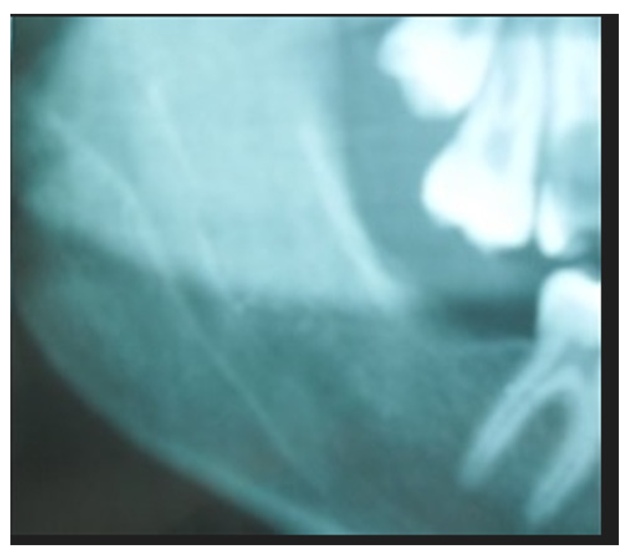 Applsci 12 12963 g009 Applsci 12 12963 g009