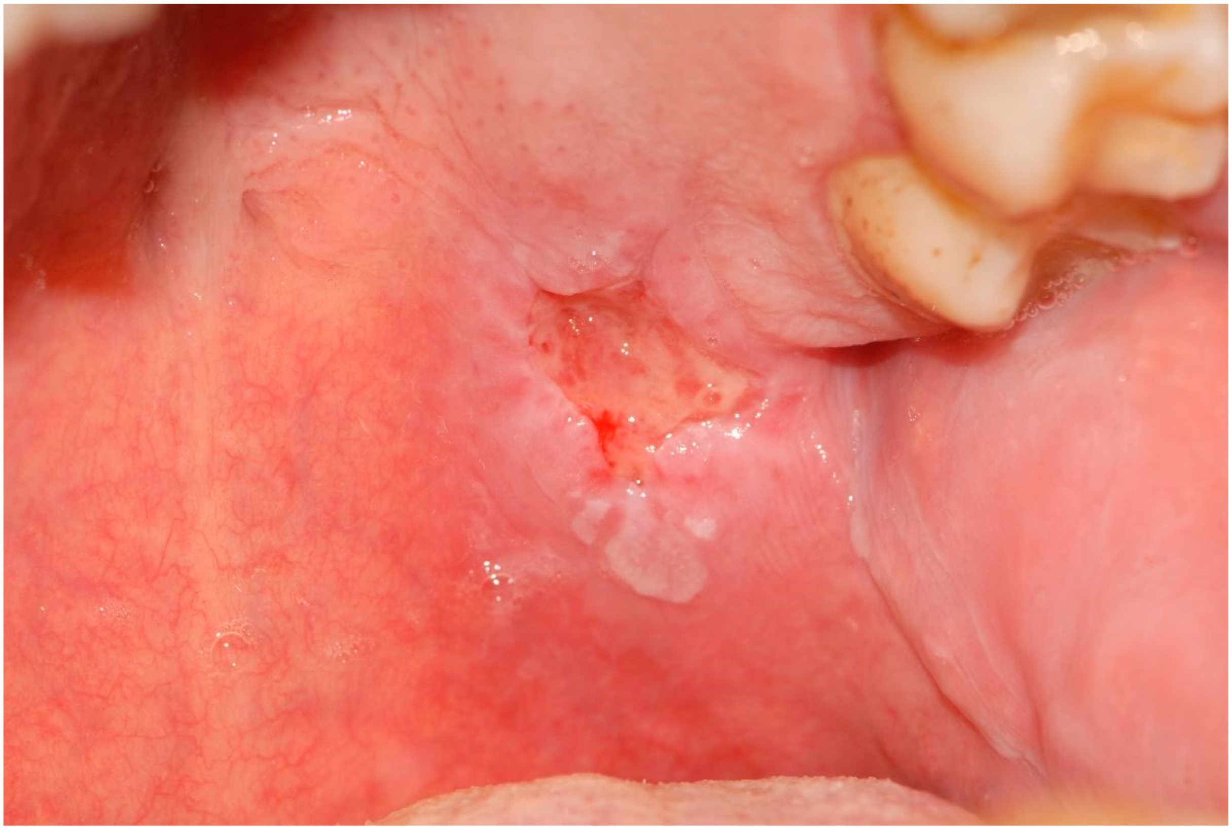 Applsci 12 12994 g005 Applsci 12 12994 g005