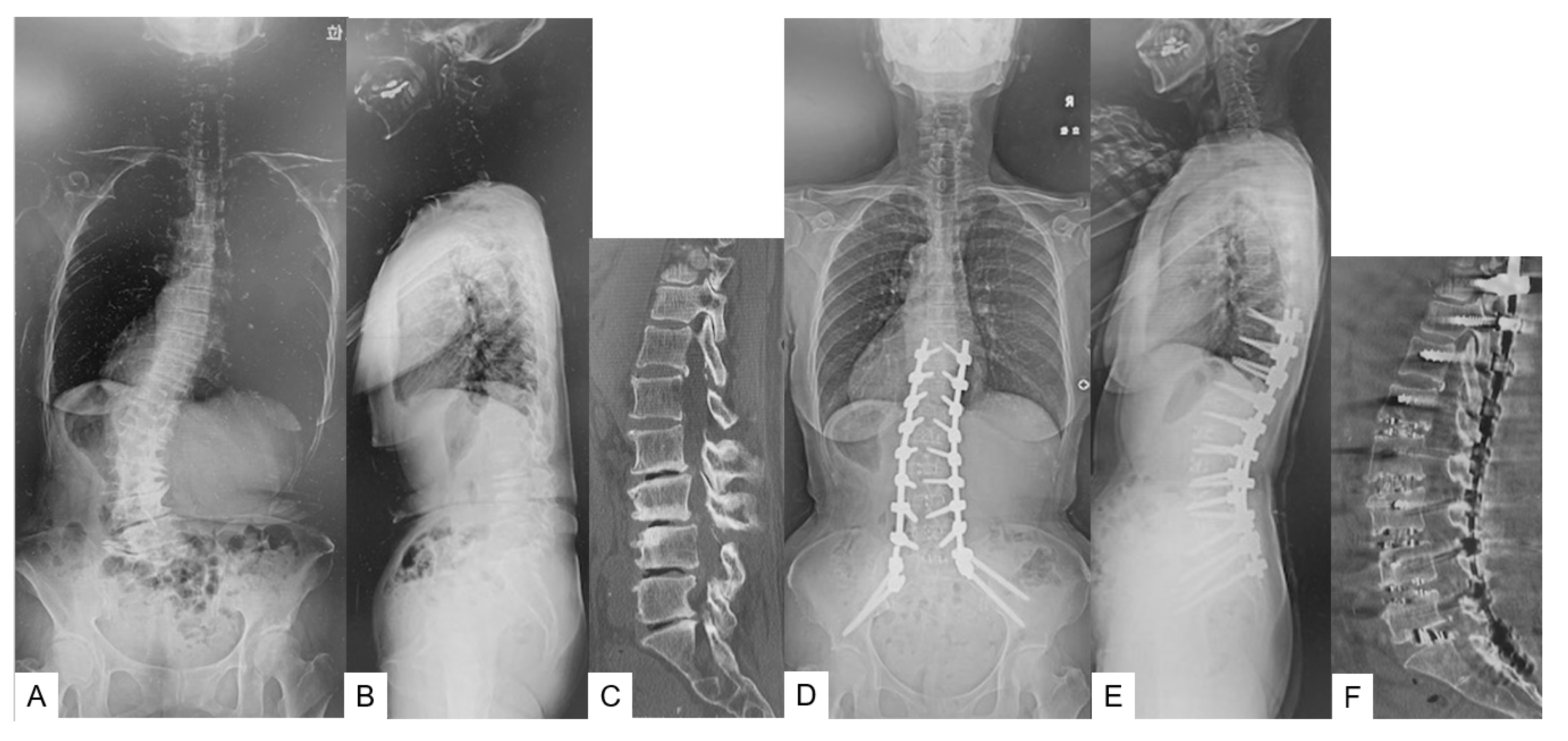 Applsci 13 00138 g006