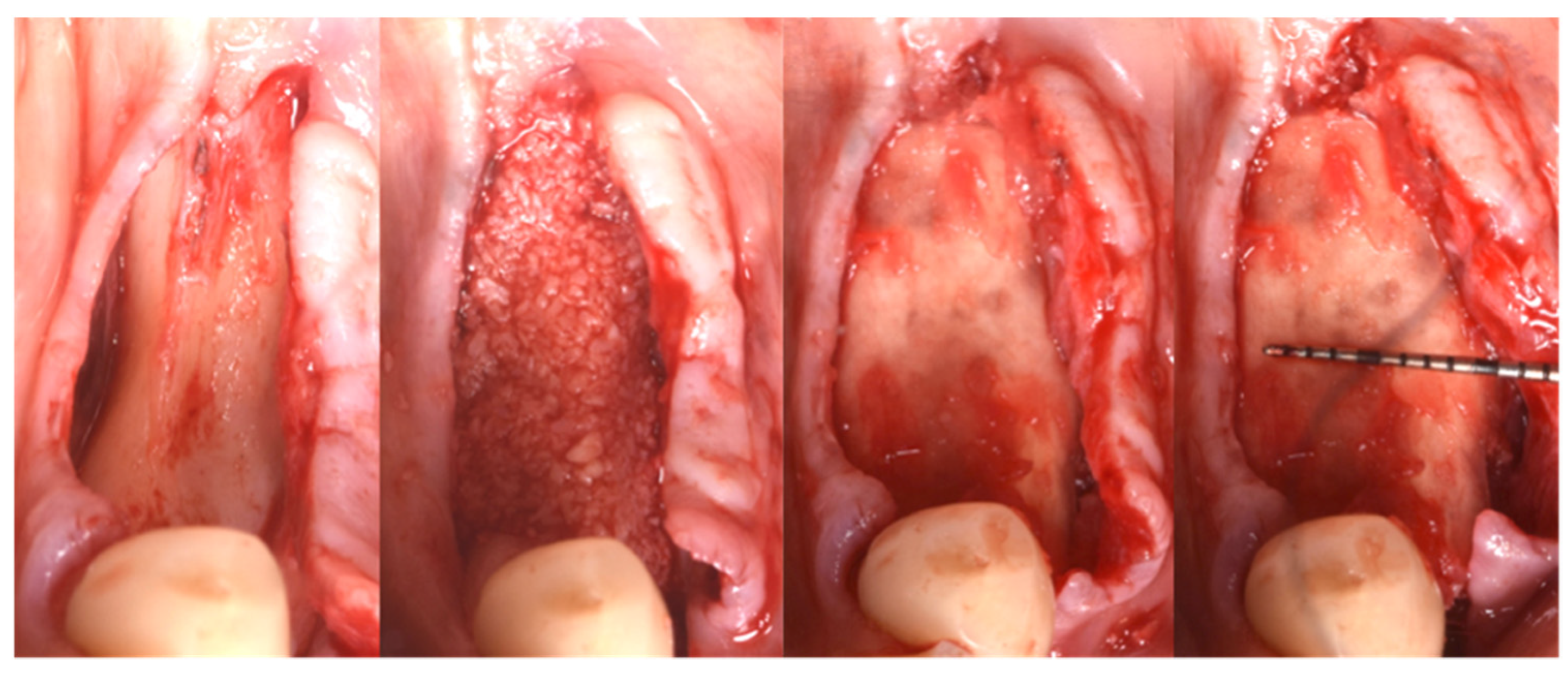 Applsci 13 00692 g006