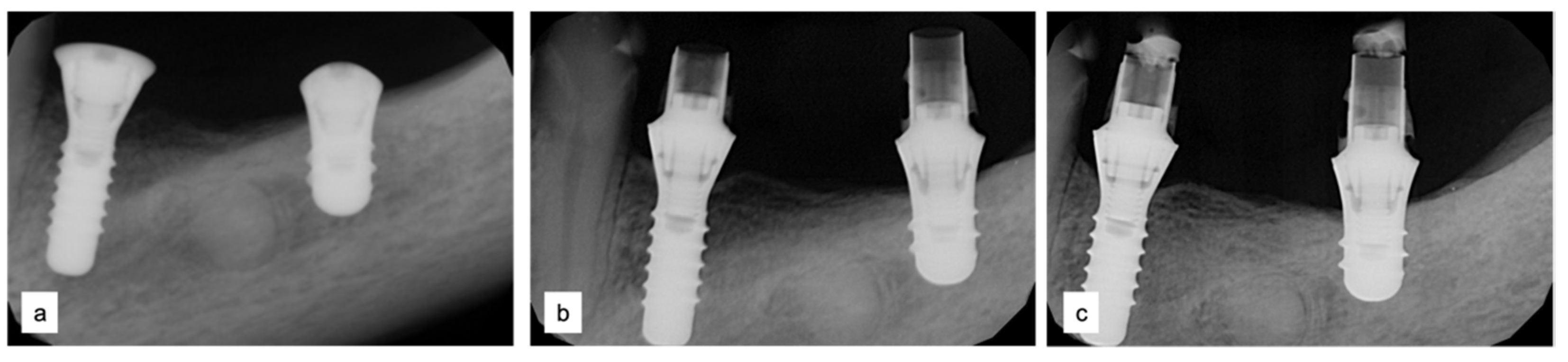 Applsci 13 00692 g009