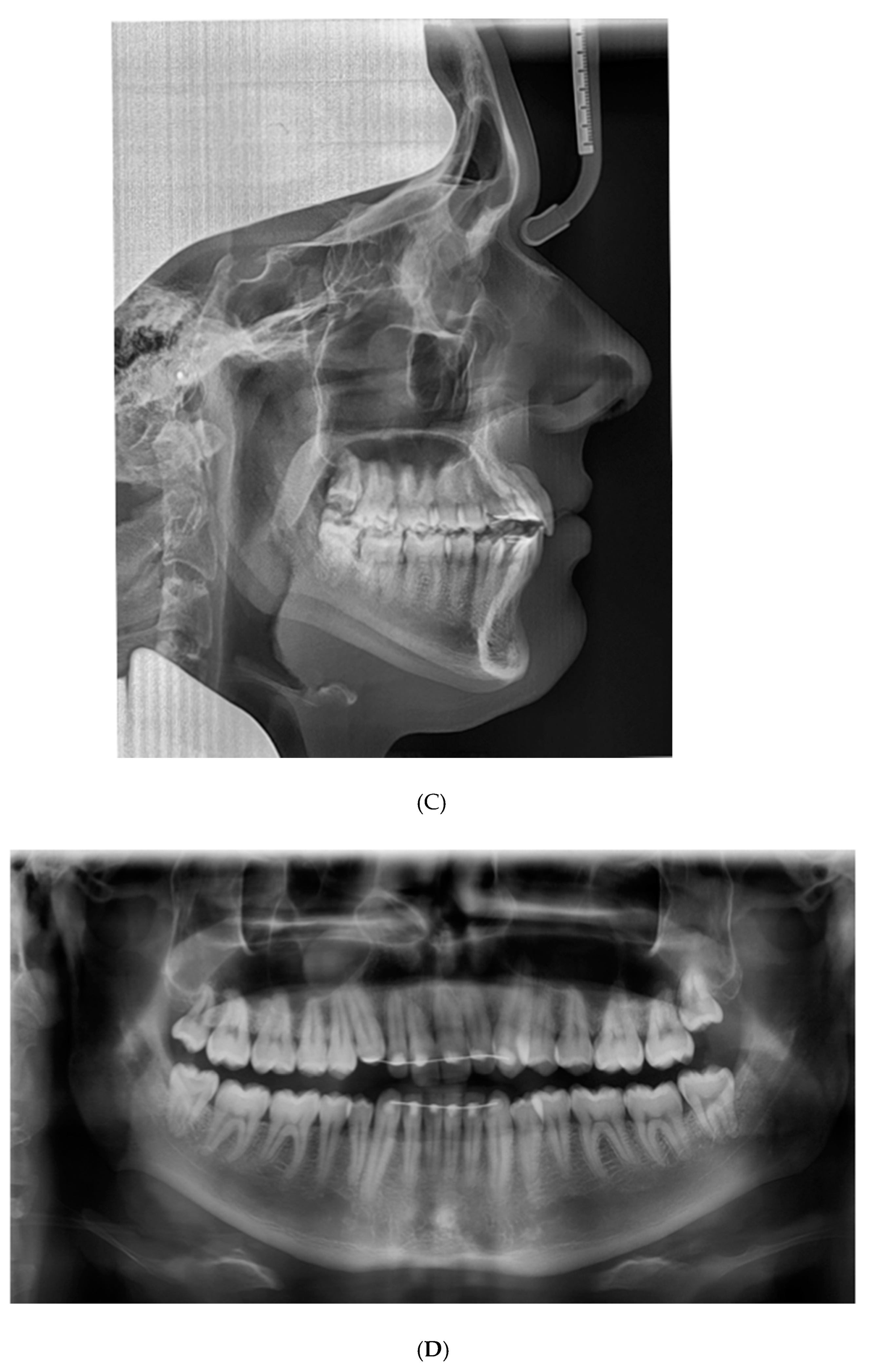 Applsci 13 00922 g003b Applsci 13 00922 g003b