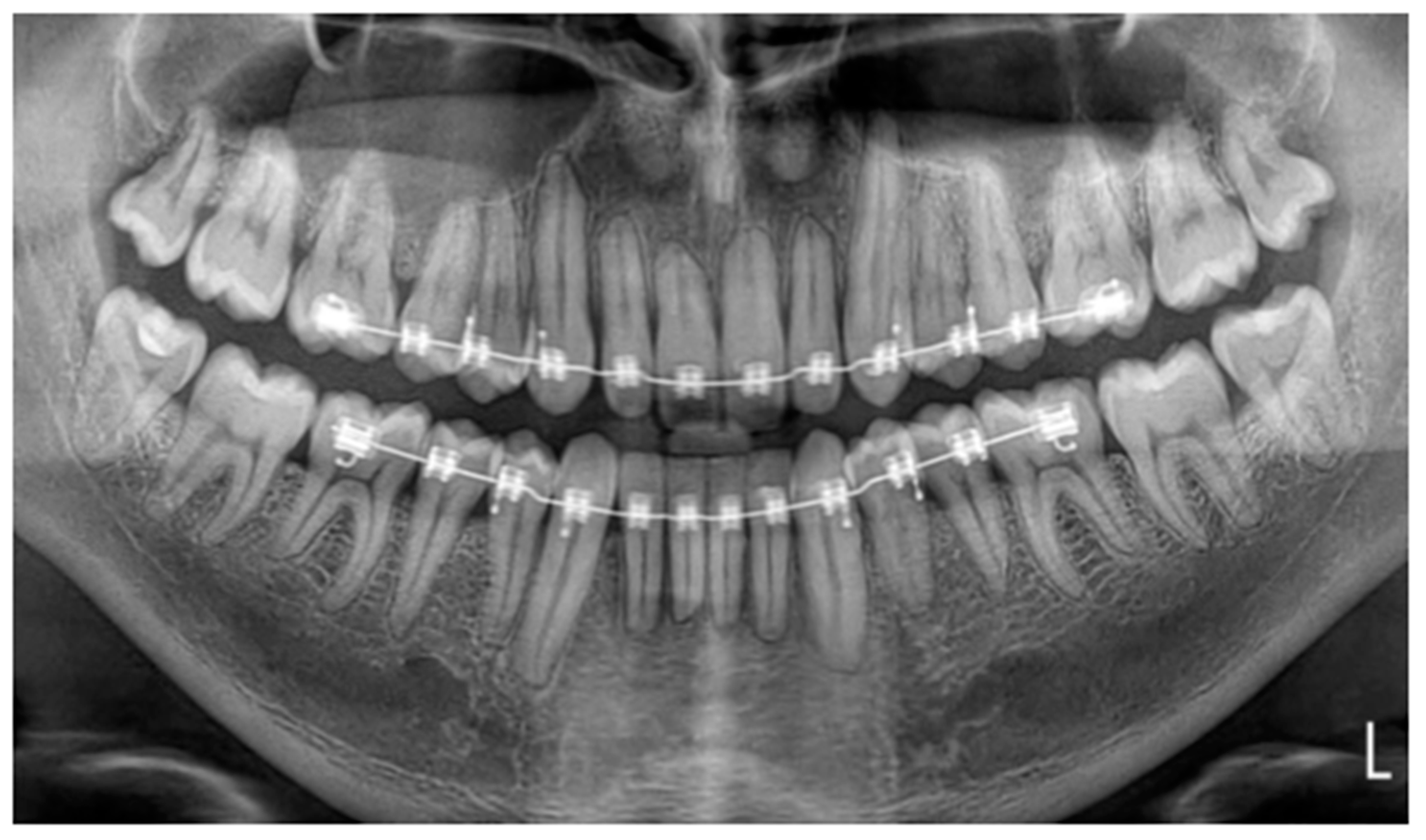 Applsci 13 00922 g004 Applsci 13 00922 g004