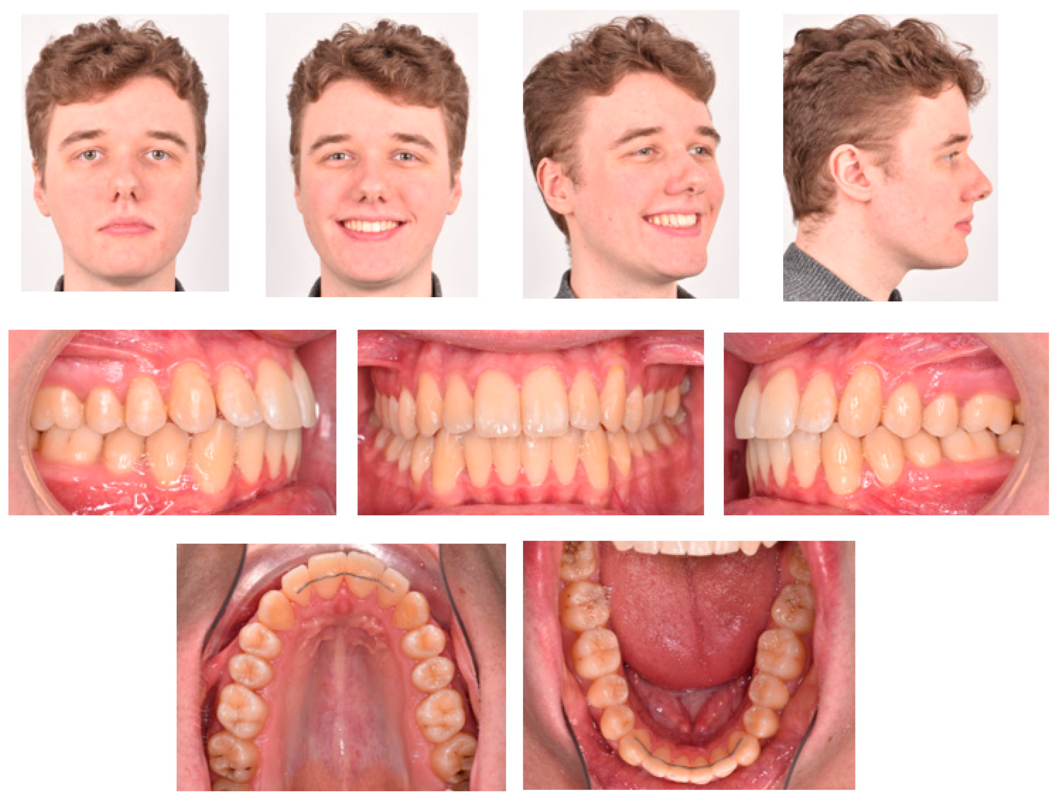 Applsci 13 00922 g005 Applsci 13 00922 g005