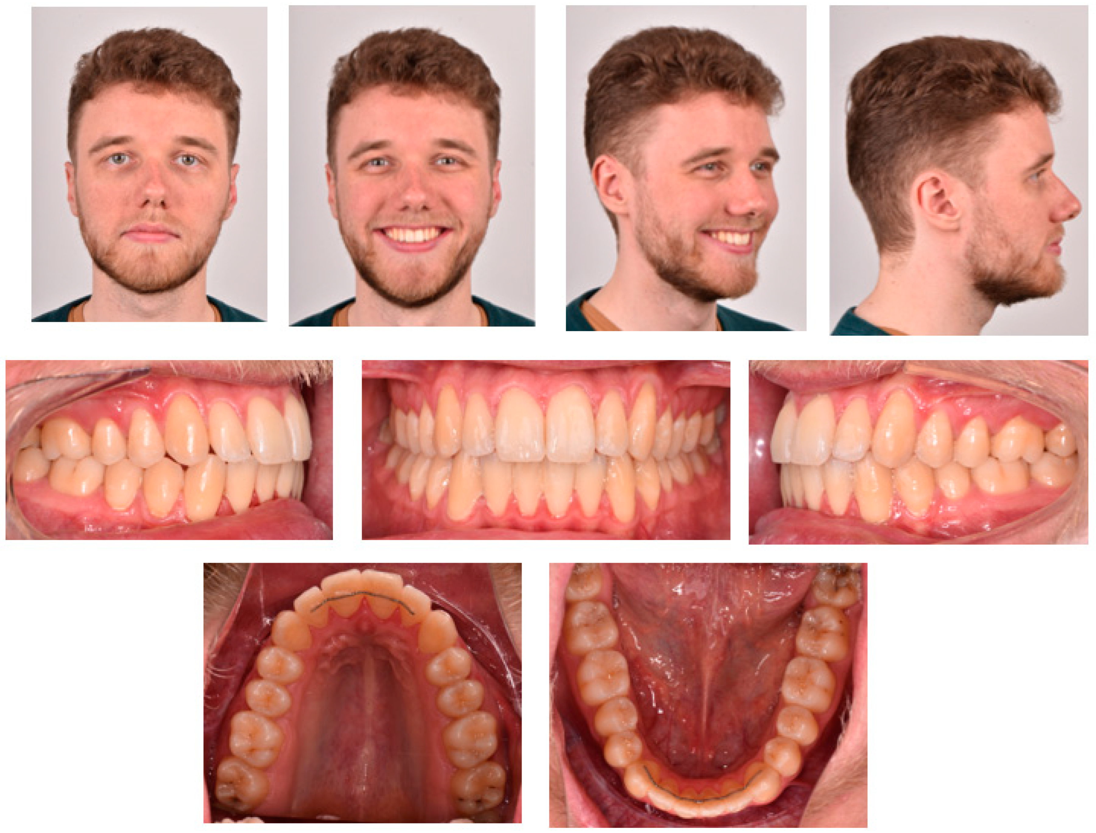 Applsci 13 00922 g006 Applsci 13 00922 g006