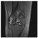 Applsci 13 01024 i001