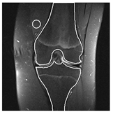 Applsci 13 01024 i007