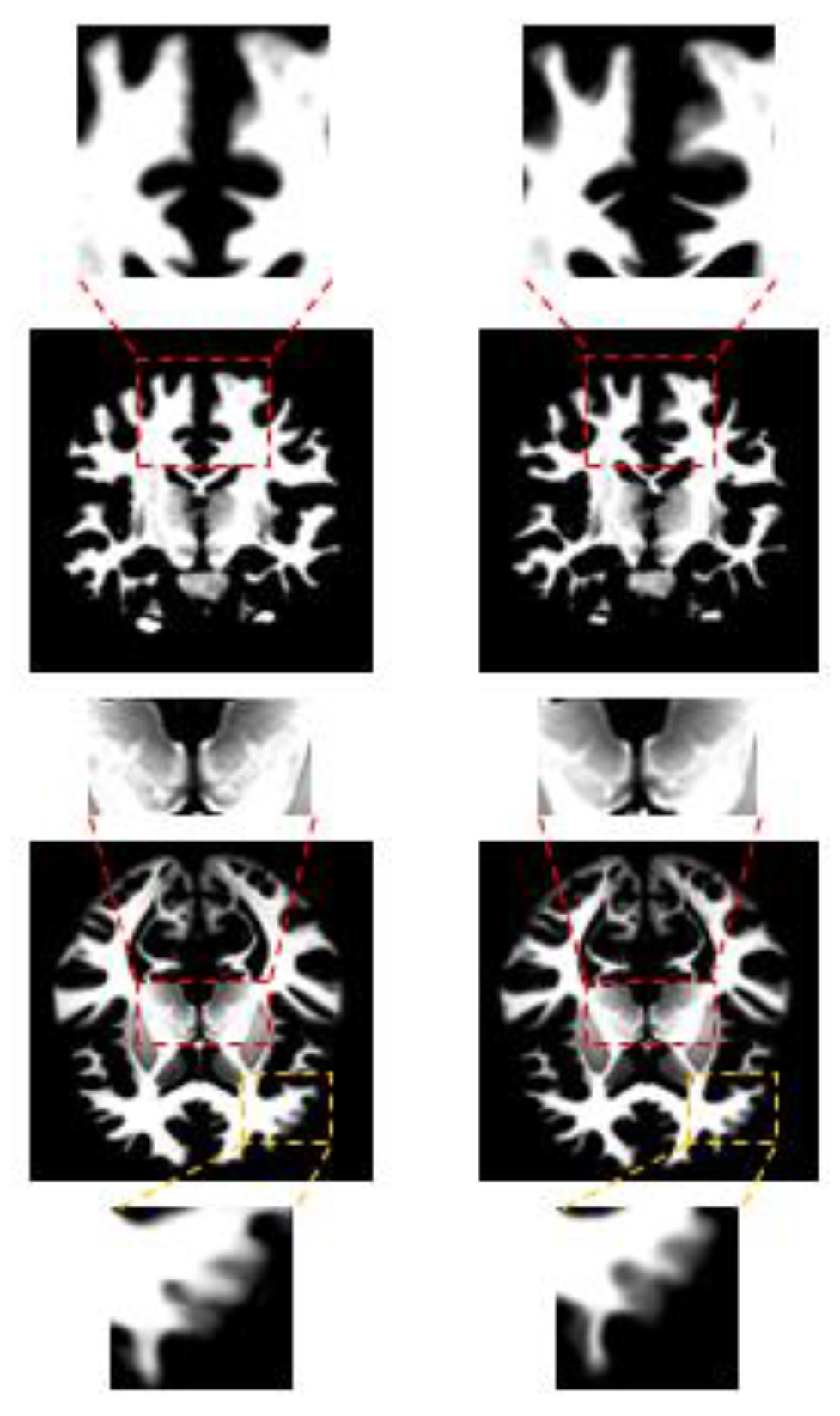 Applsci 13 01040 g006 Applsci 13 01040 g006