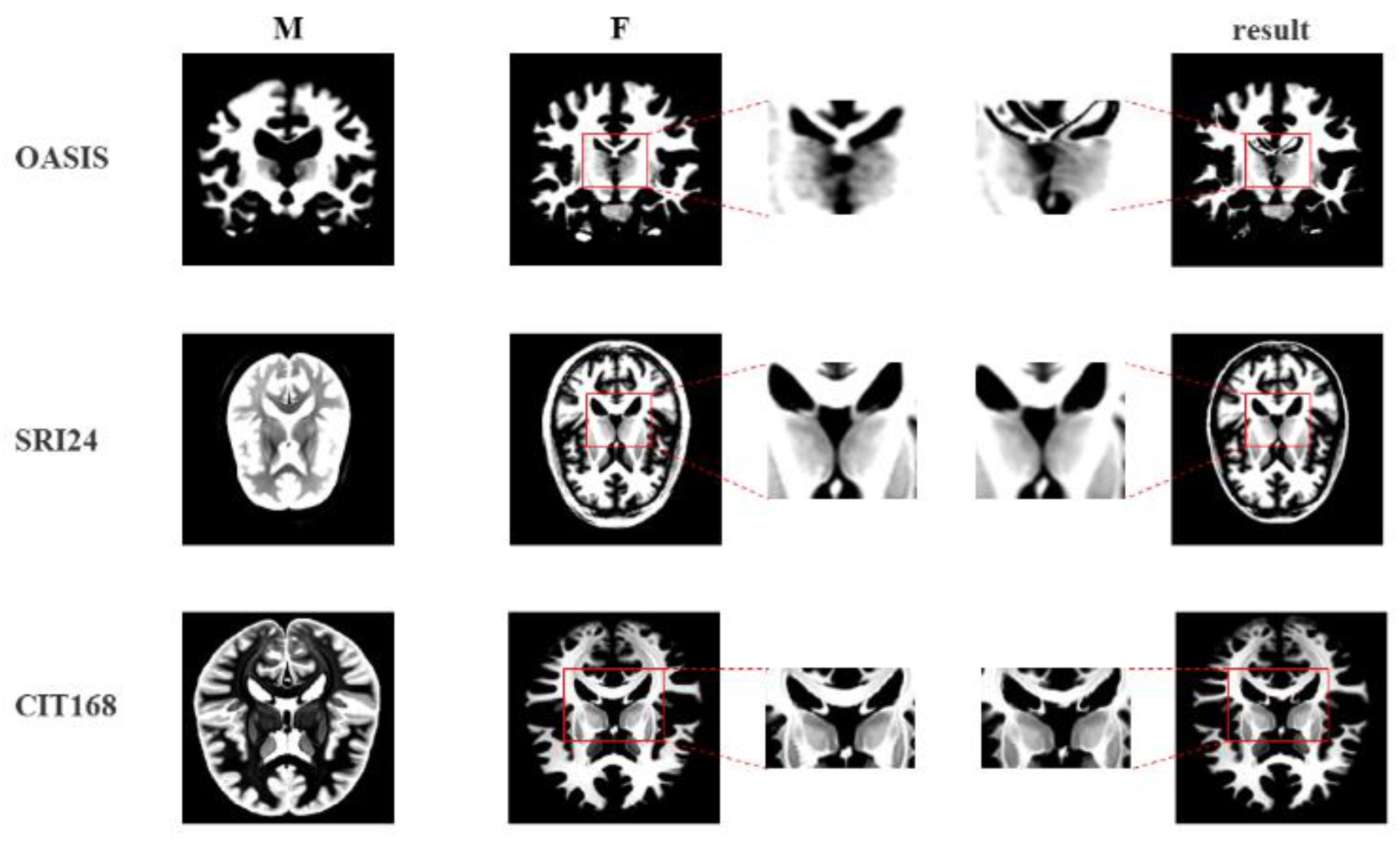 Applsci 13 01040 g011 Applsci 13 01040 g011