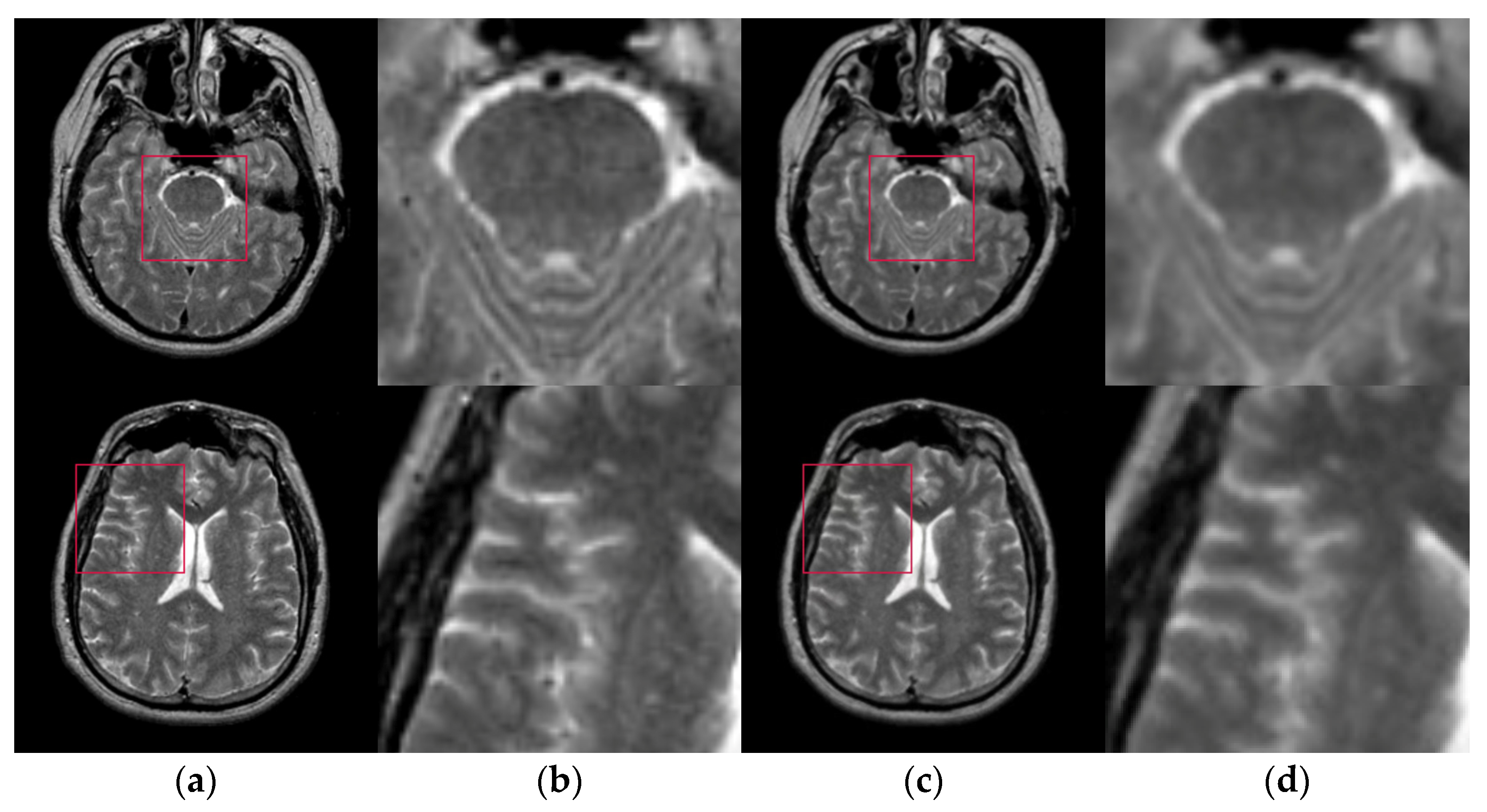 Applsci 13 01087 g006 Applsci 13 01087 g006