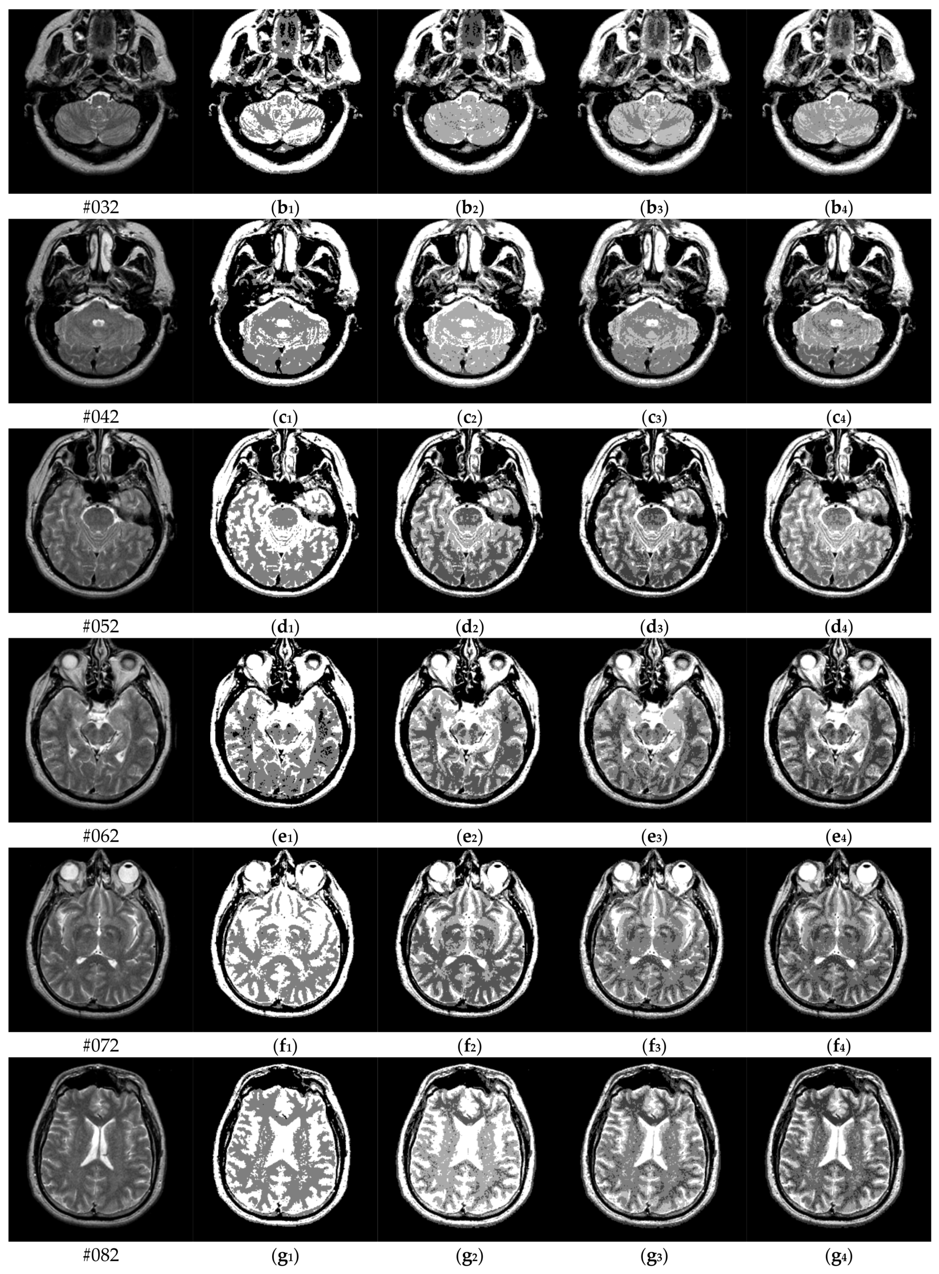 Applsci 13 01087 g008b Applsci 13 01087 g008b