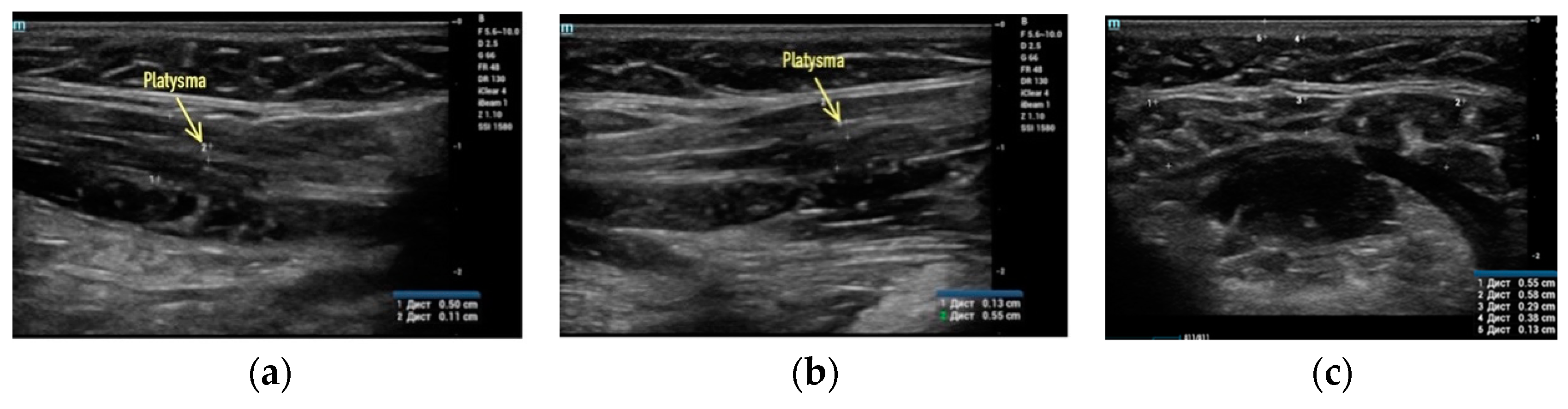 Applsci 13 01128 g002 Applsci 13 01128 g002