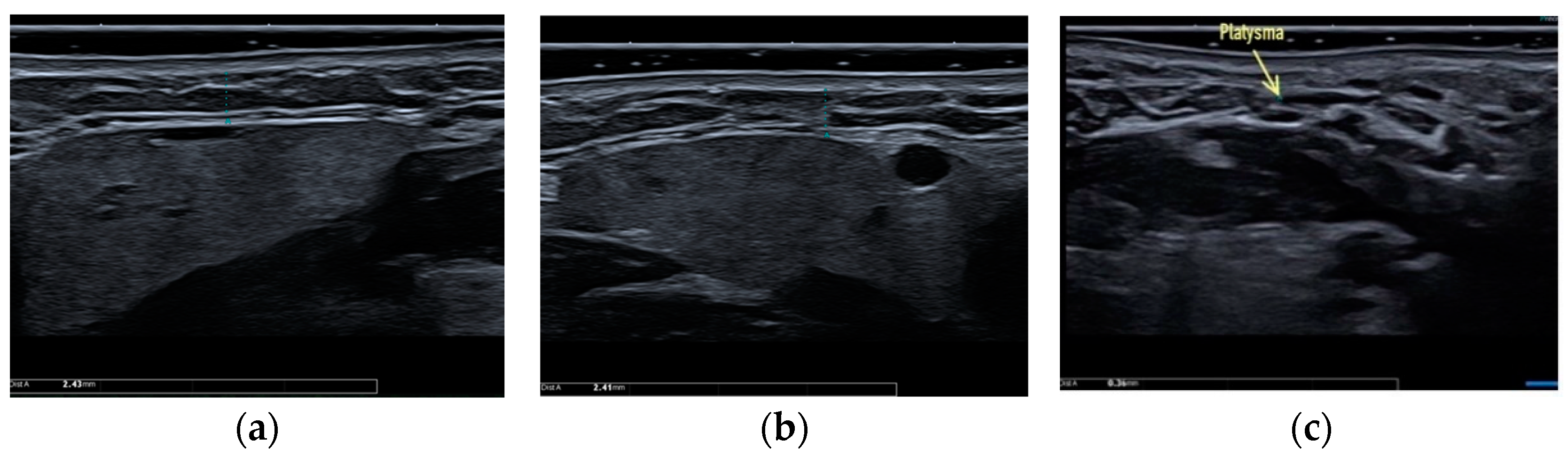Applsci 13 01128 g003 Applsci 13 01128 g003