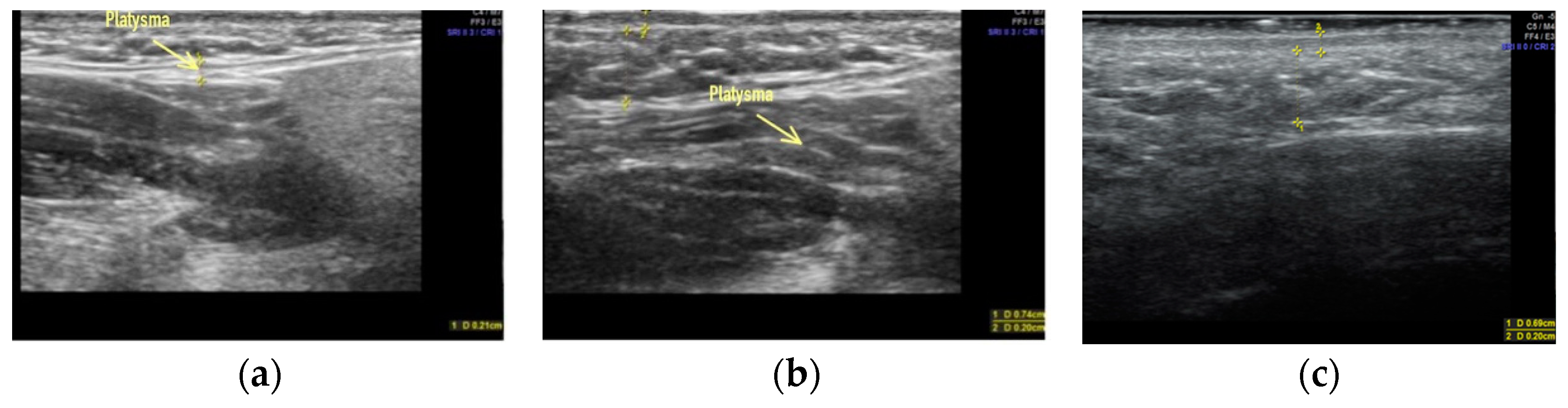 Applsci 13 01128 g005 Applsci 13 01128 g005