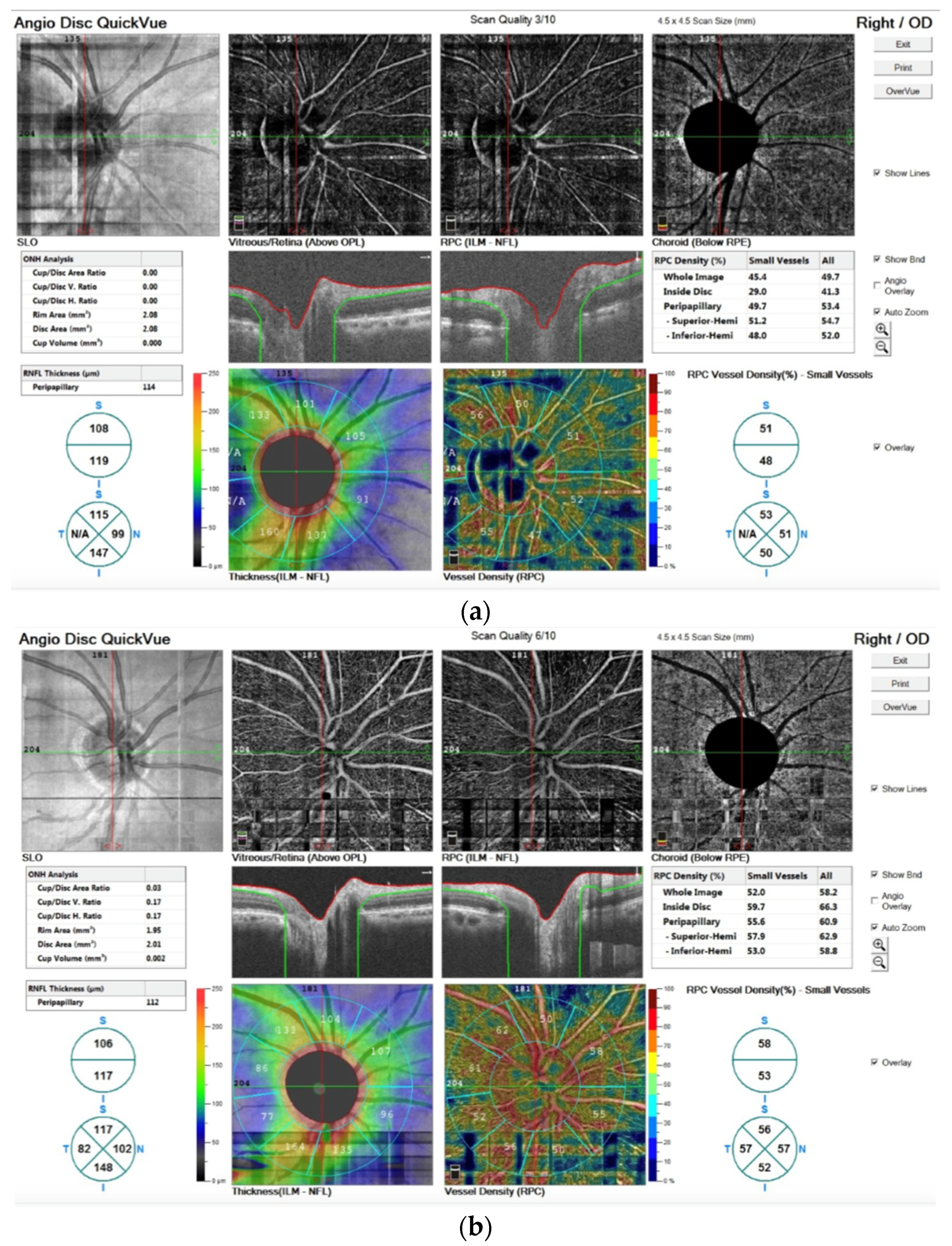 Applsci 13 01152 g005