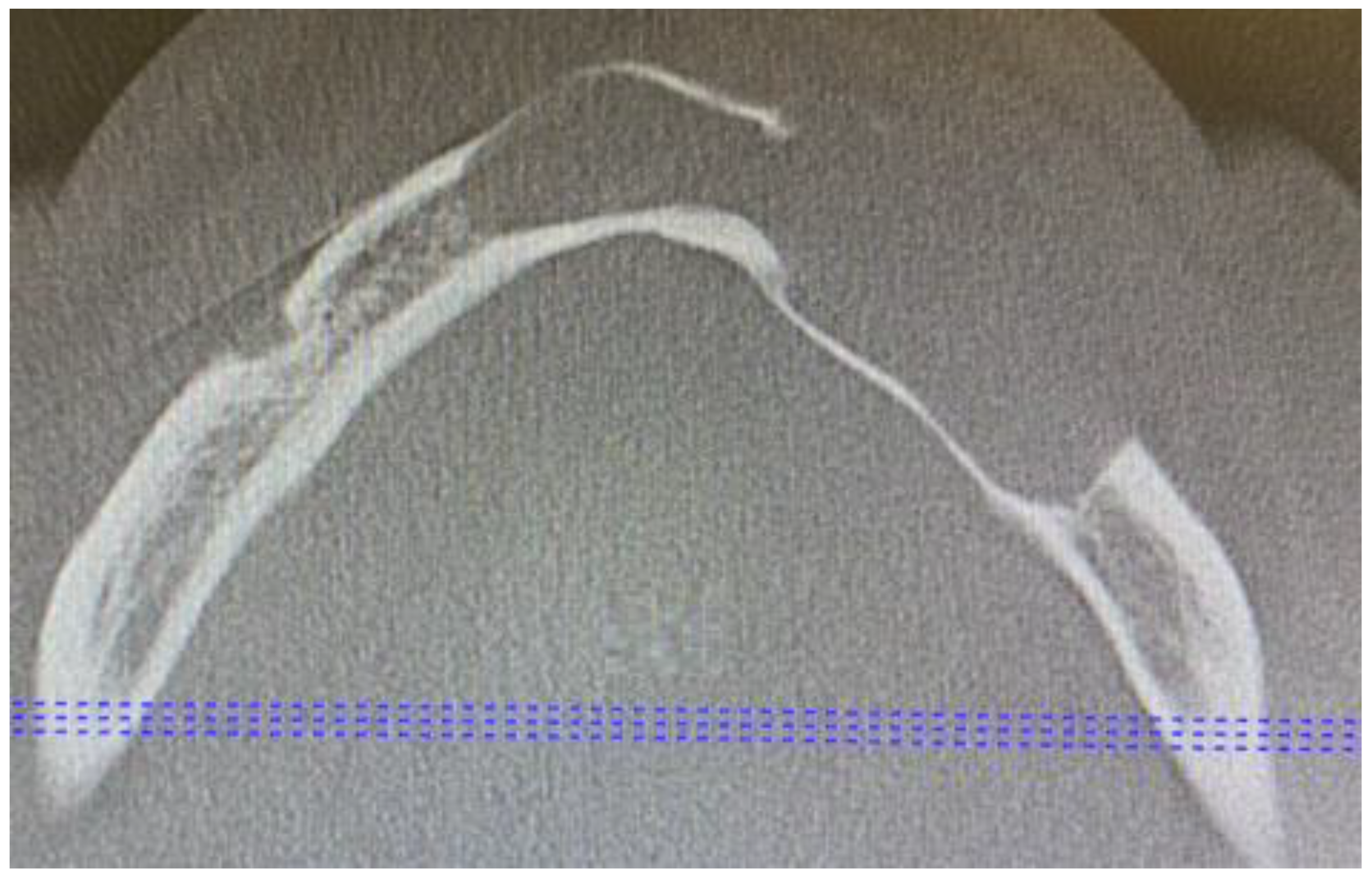 Applsci 13 01234 g003