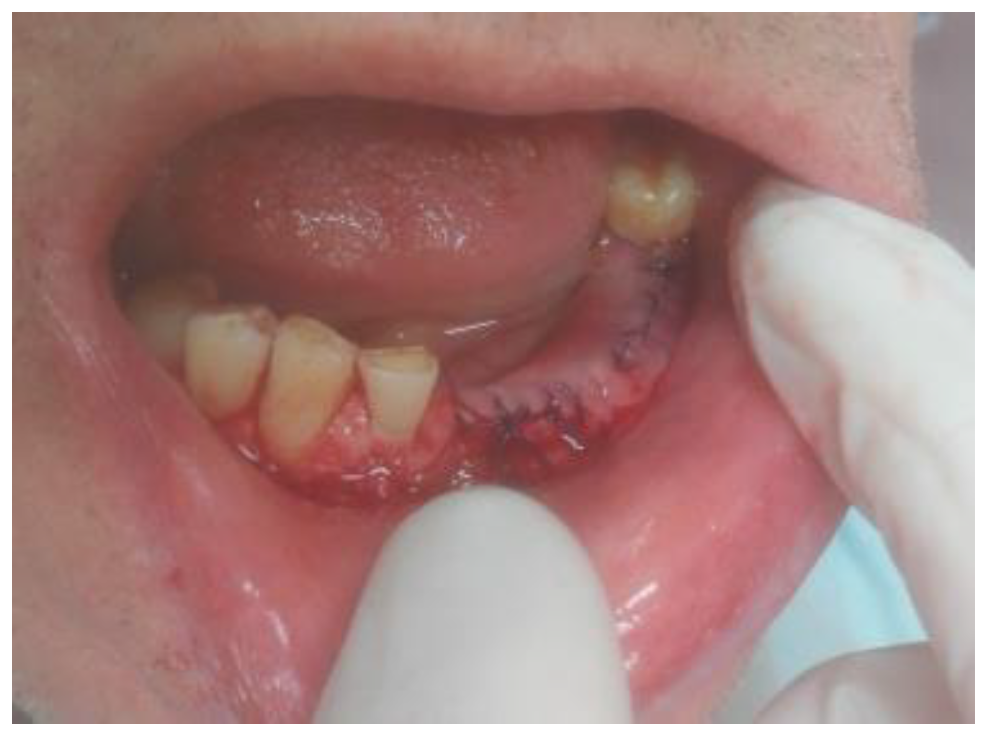 Applsci 13 01234 g005