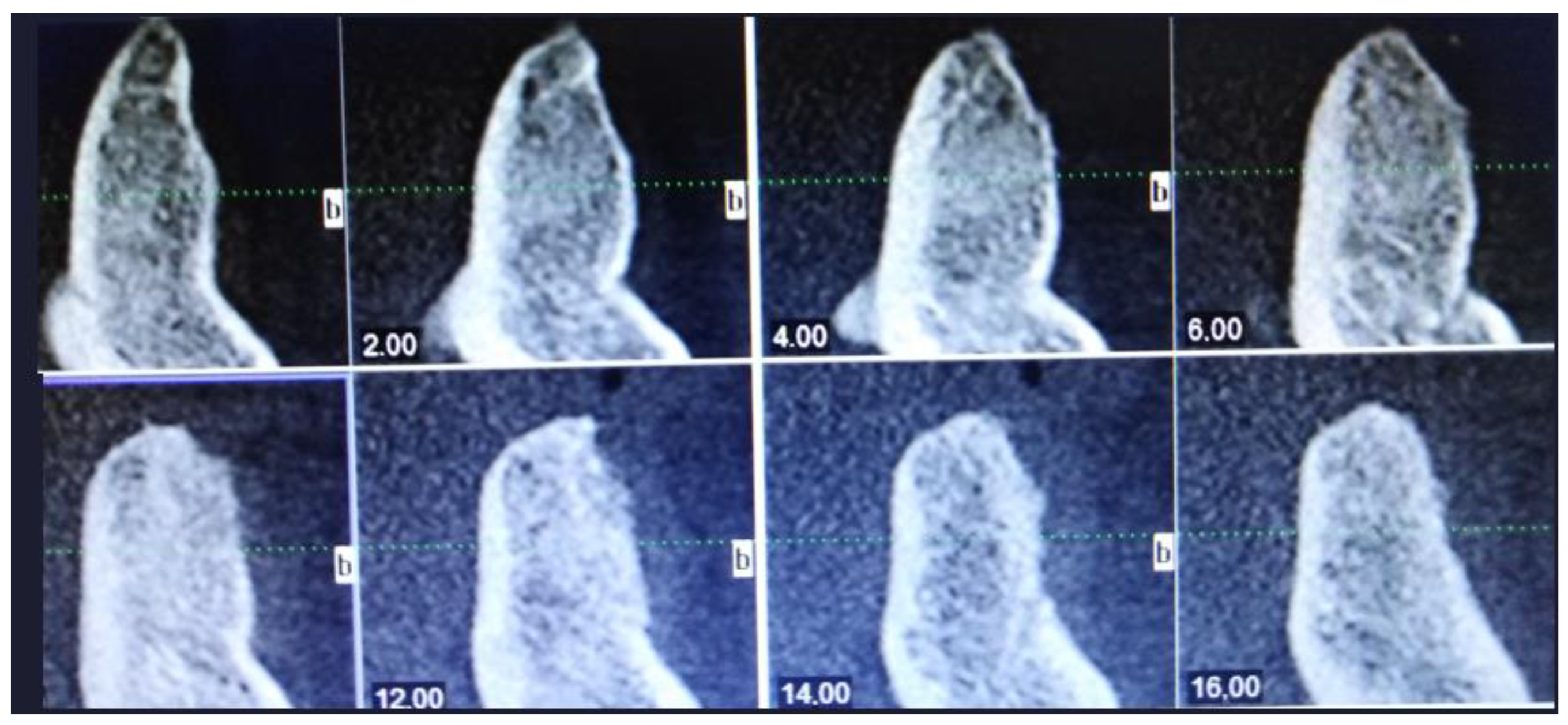 Applsci 13 01234 g012