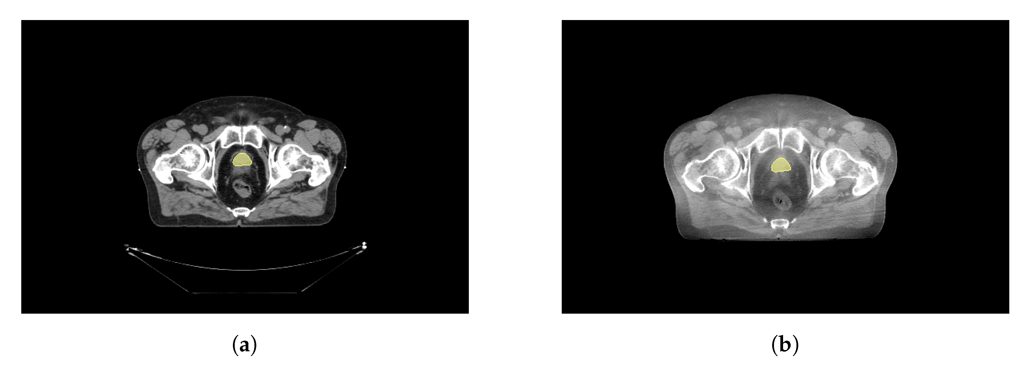 Applsci 13 01378 g002