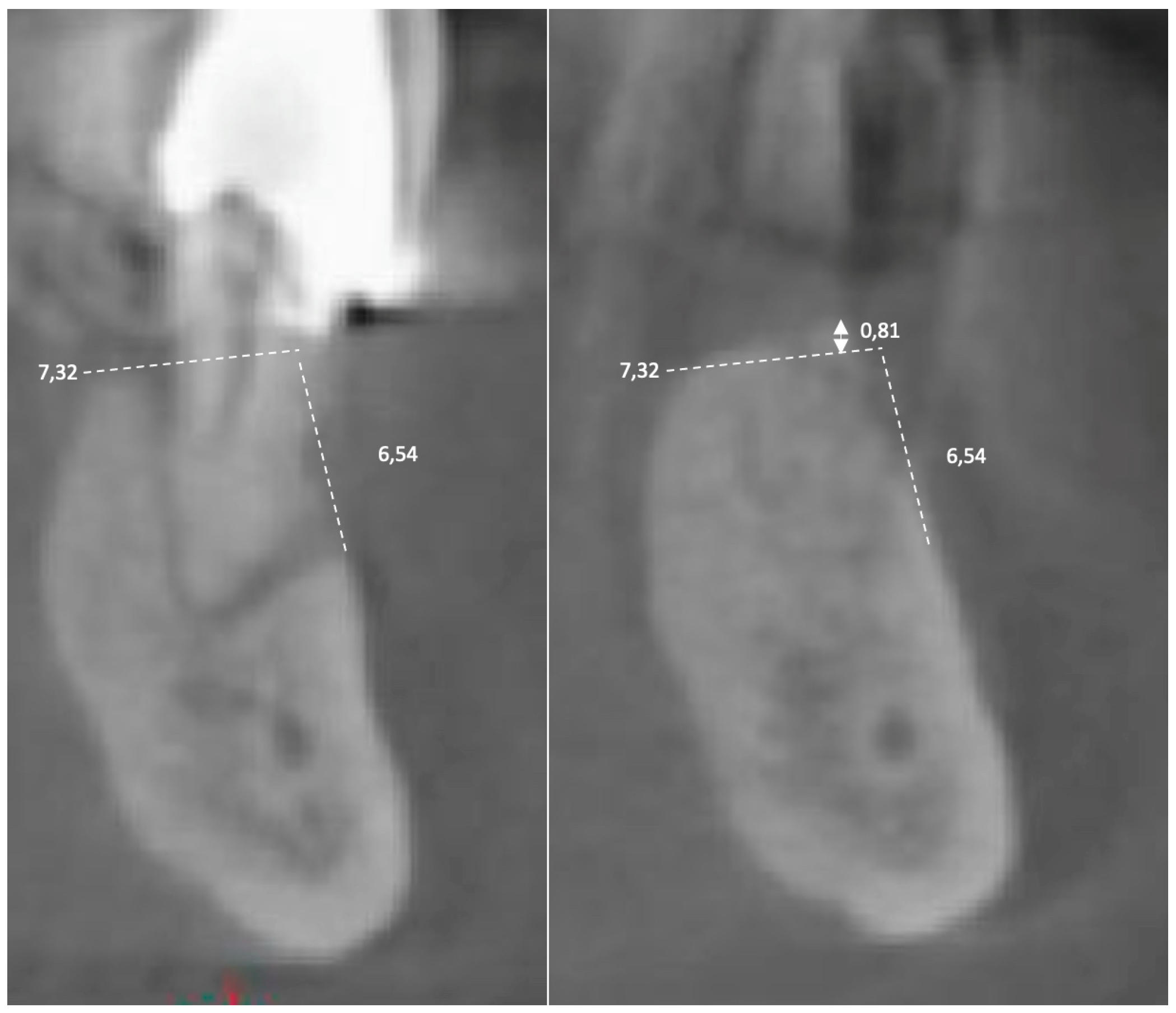 Applsci 13 01411 g003