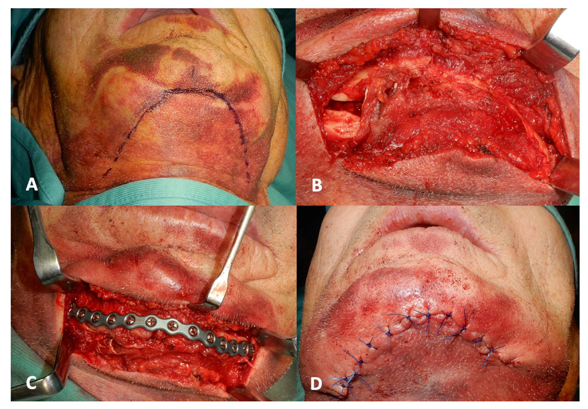 Applsci 13 01474 g002