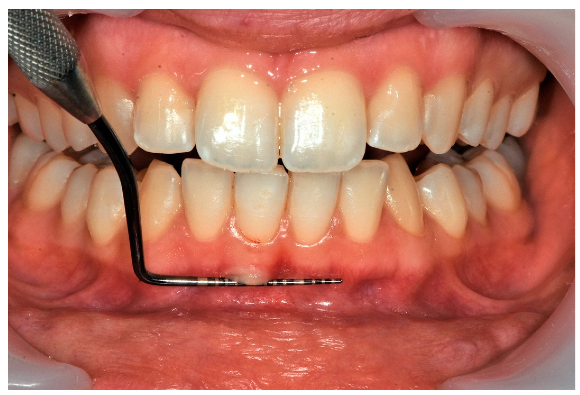 Applsci 13 01561 g003