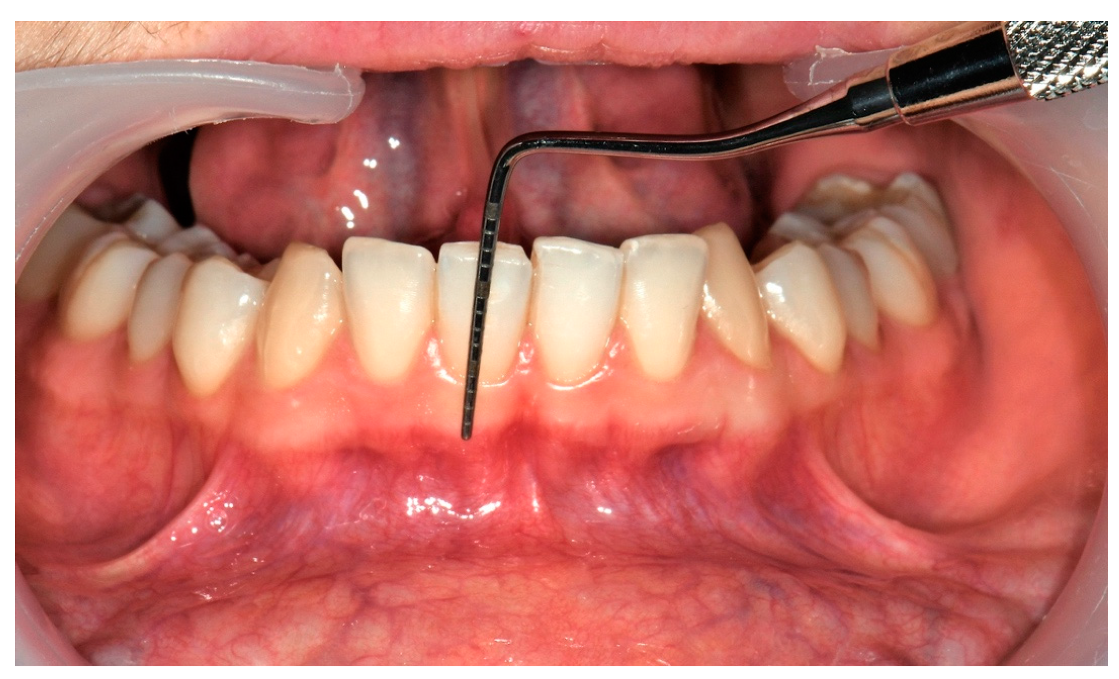 Applsci 13 01561 g004