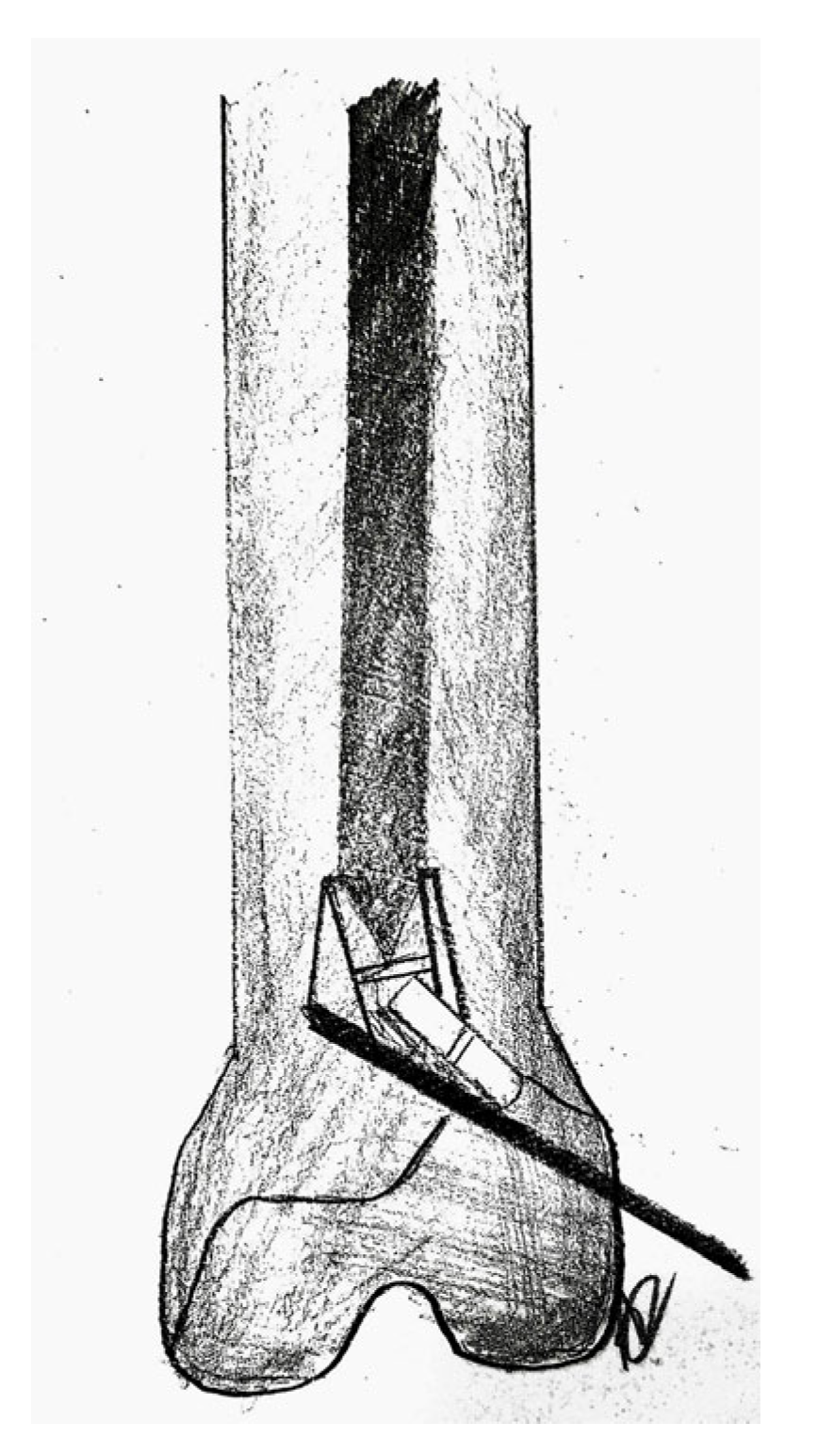 Applsci 13 01645 g018