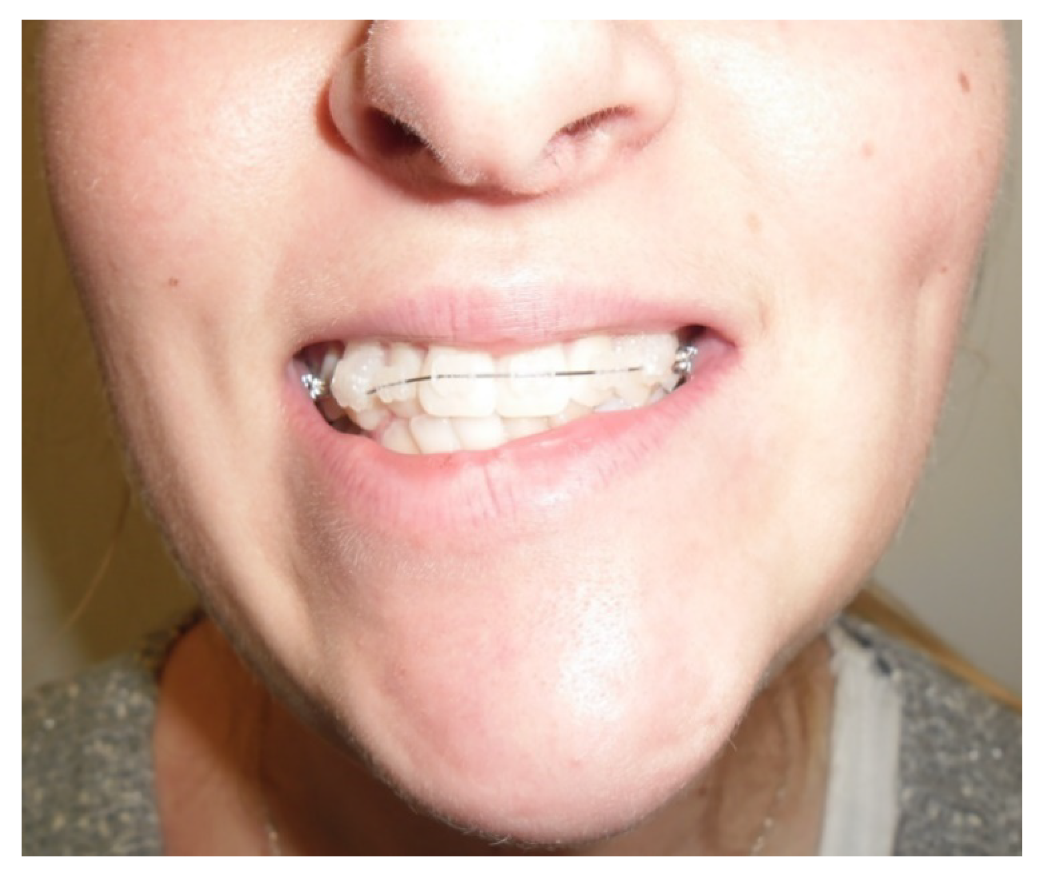 Applsci 13 01839 g002 Applsci 13 01839 g002