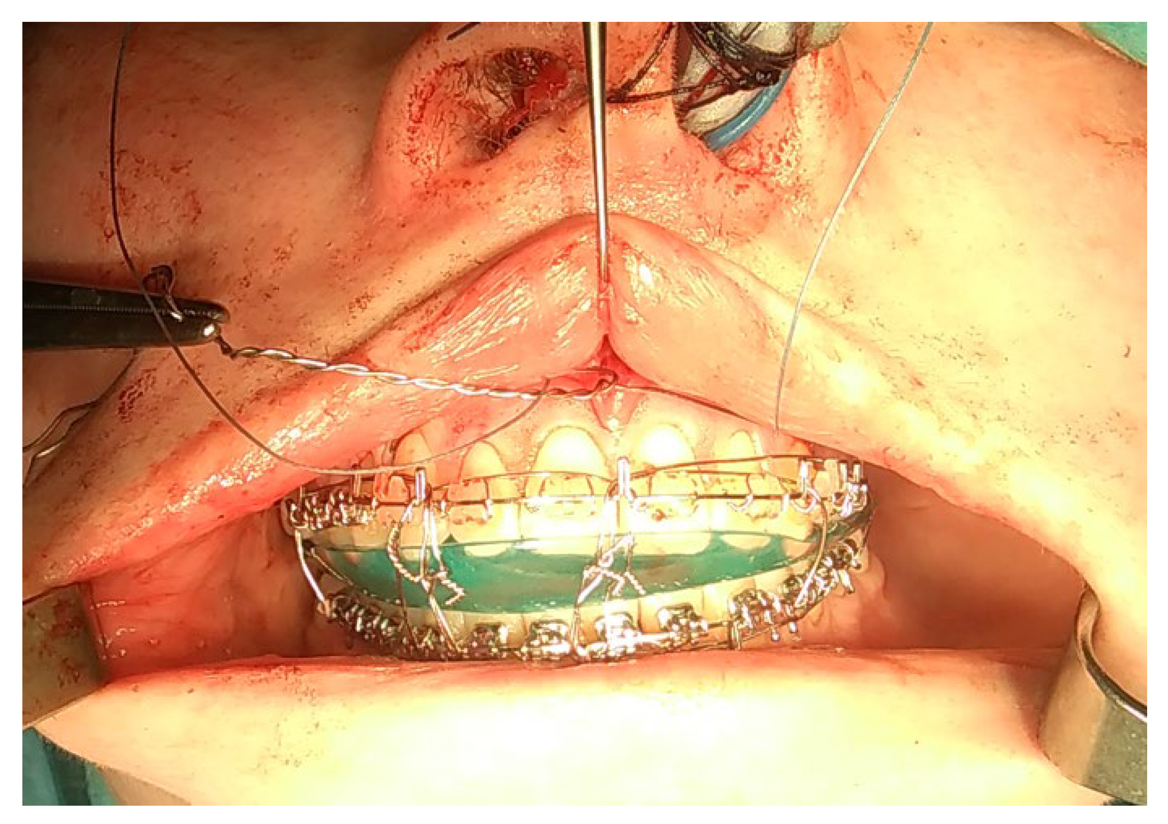 Applsci 13 01839 g007 Applsci 13 01839 g007