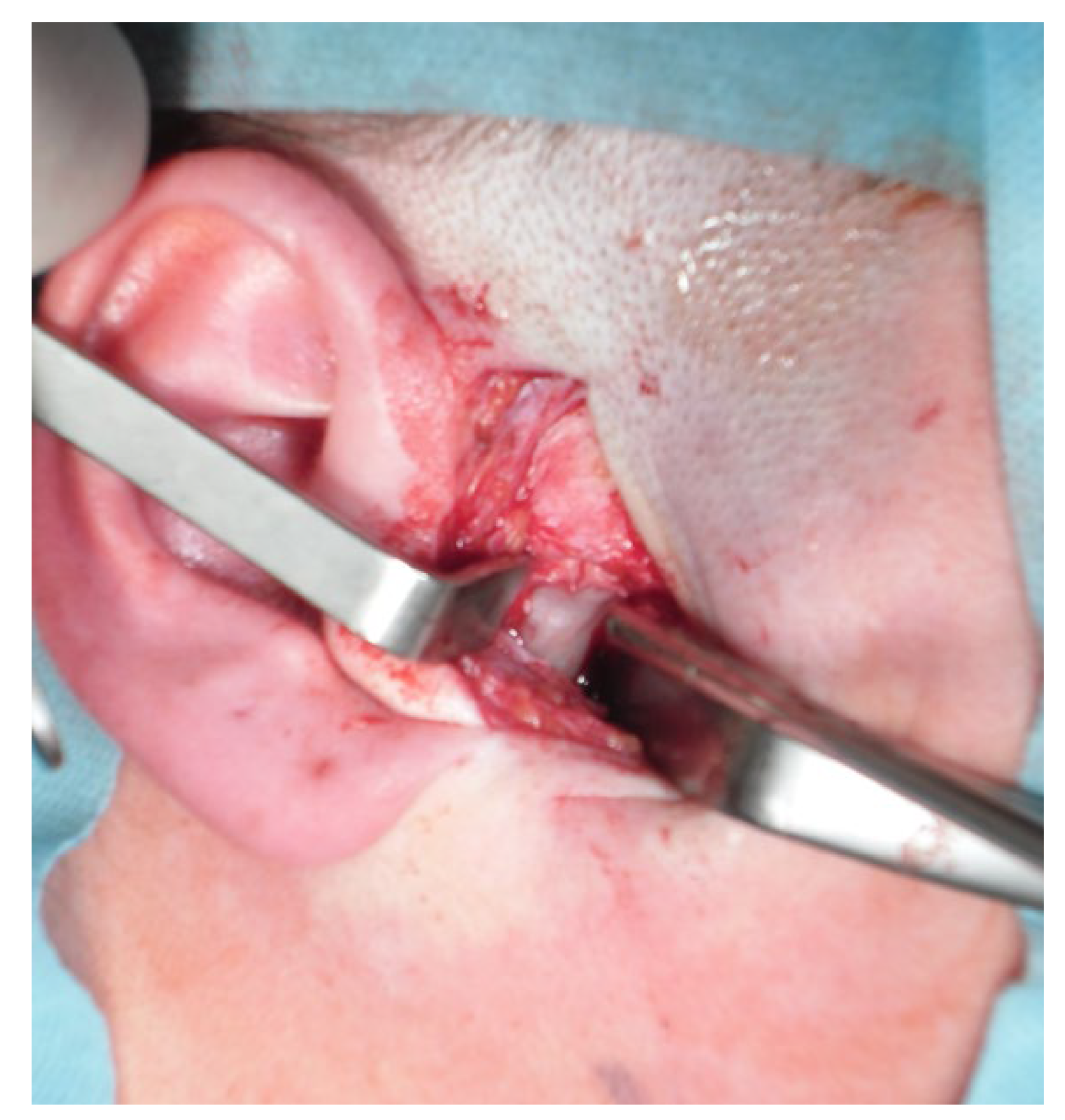 Applsci 13 01839 g008 Applsci 13 01839 g008