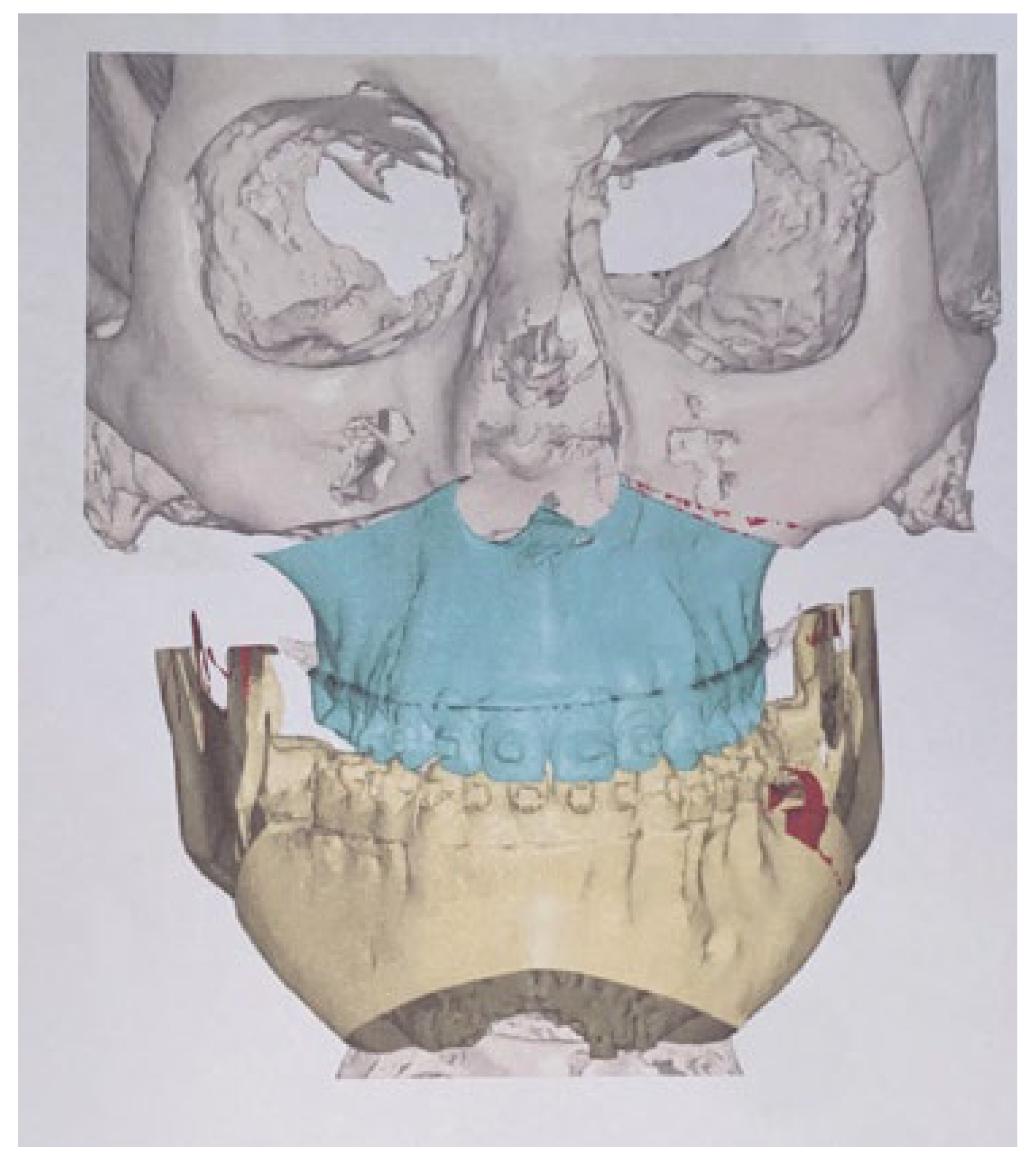 Applsci 13 01839 g012 Applsci 13 01839 g012