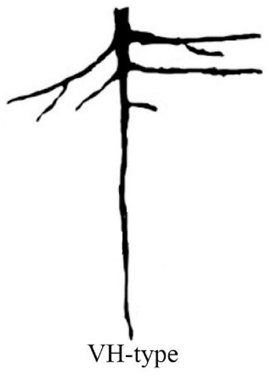 Elm Root System A 3D Model Applied to Analyze the Mechanical Characteristic of Living ...