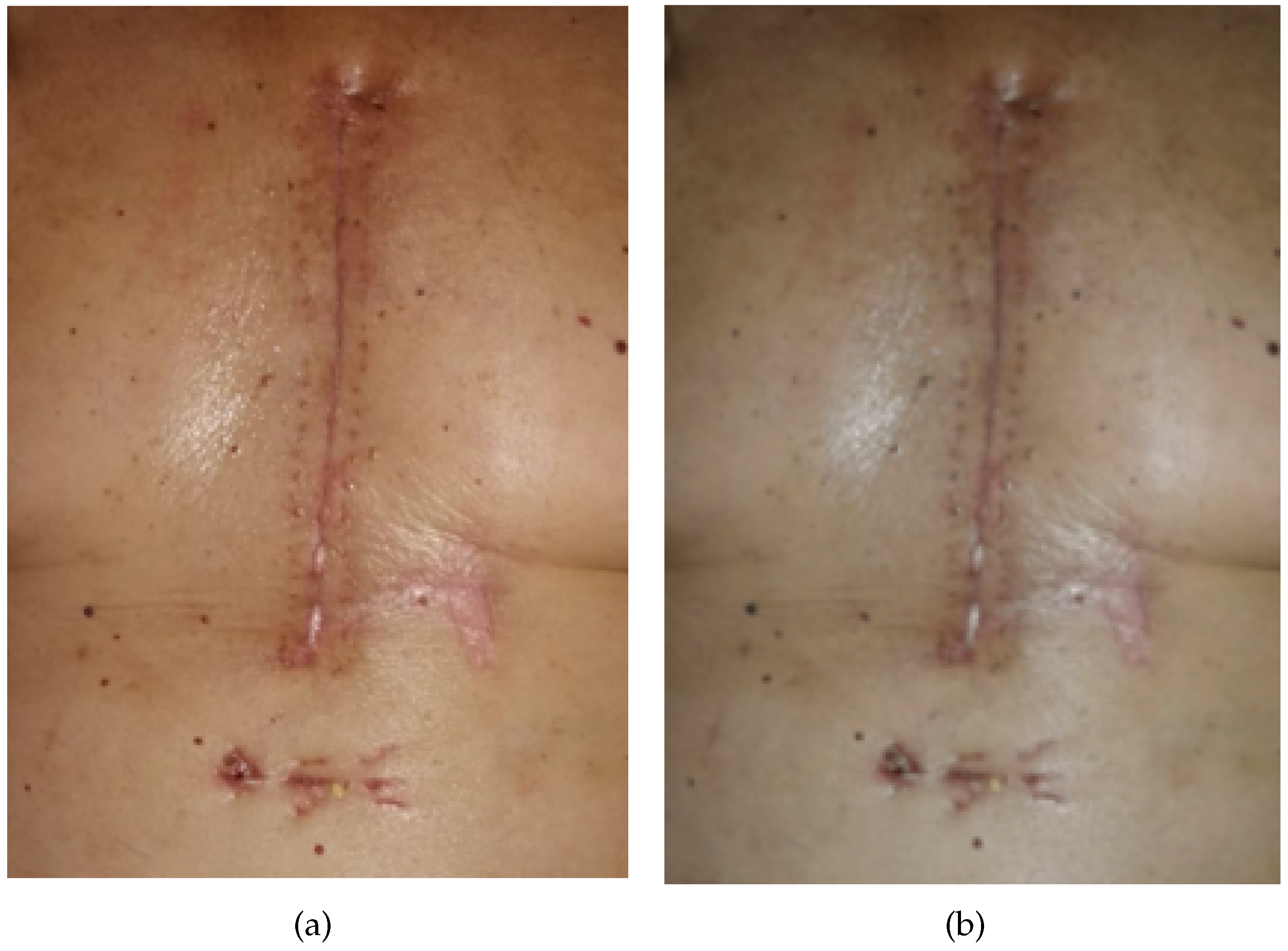 Applsci 13 02120 g004