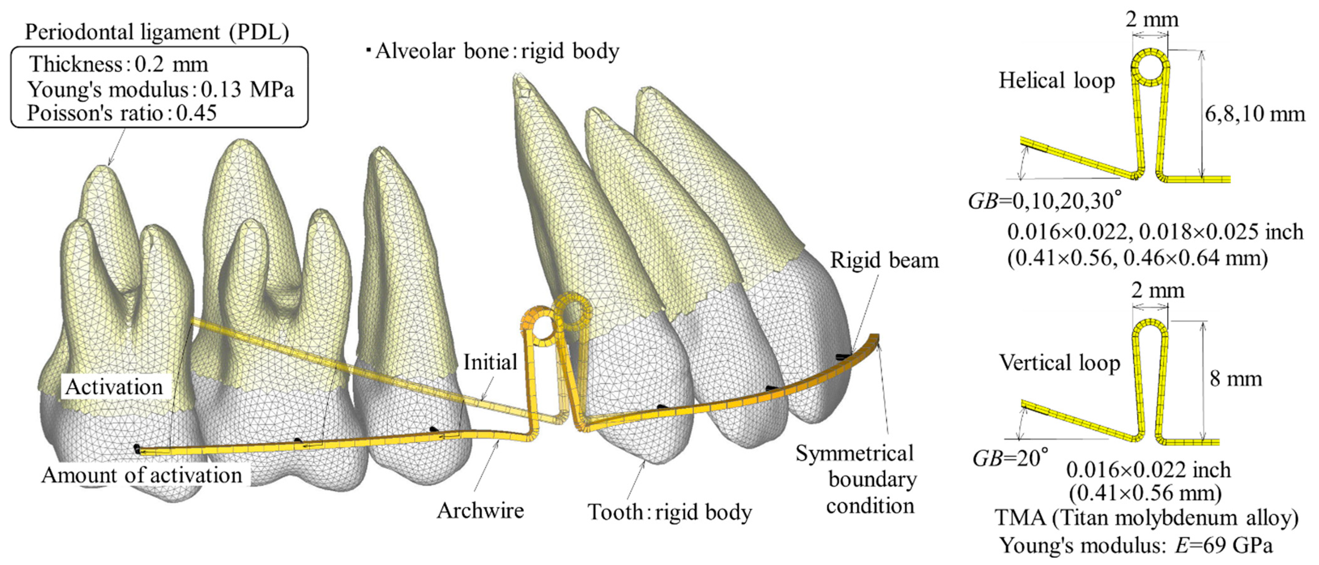 PDF) Clinical application of group B T-loop spring for retraction