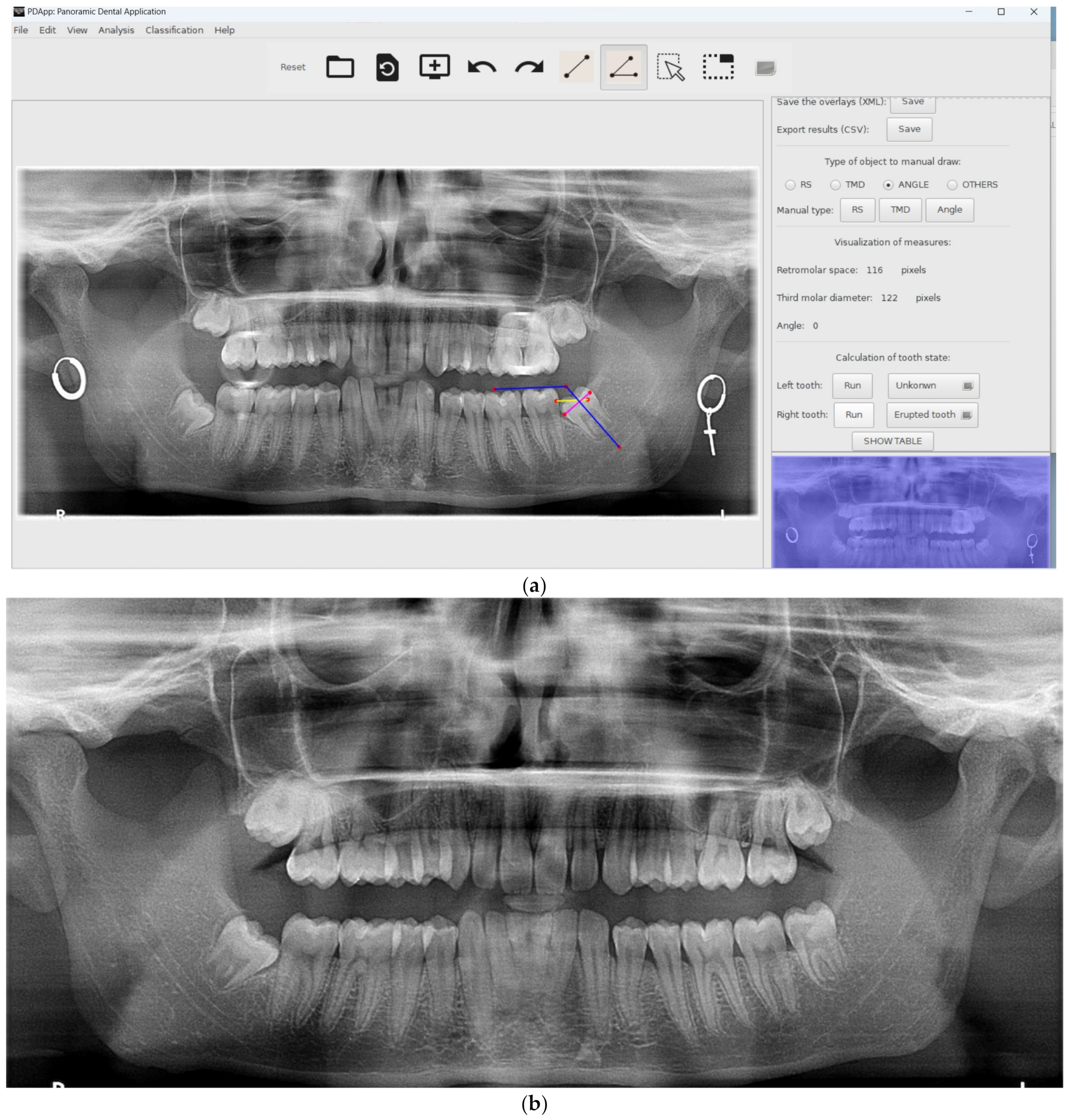 Applsci 13 02848 g005