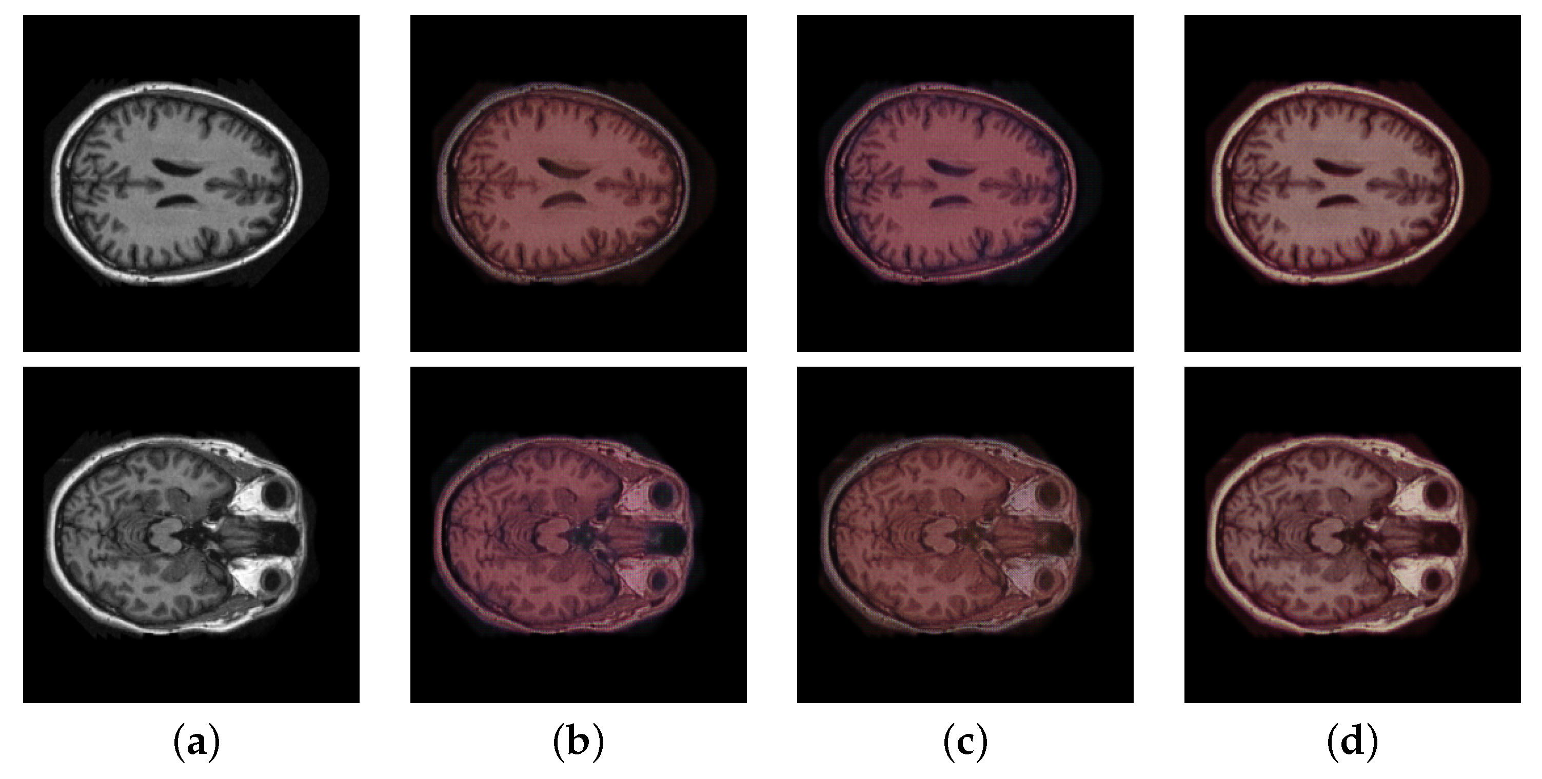 Applsci 13 03168 g005 Applsci 13 03168 g005