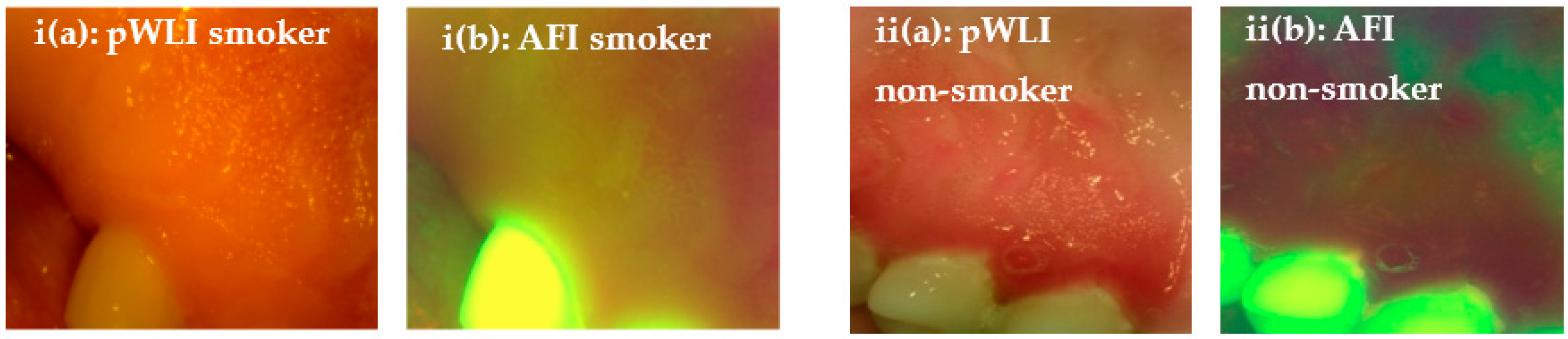 Applsci 13 03370 g005 Applsci 13 03370 g005