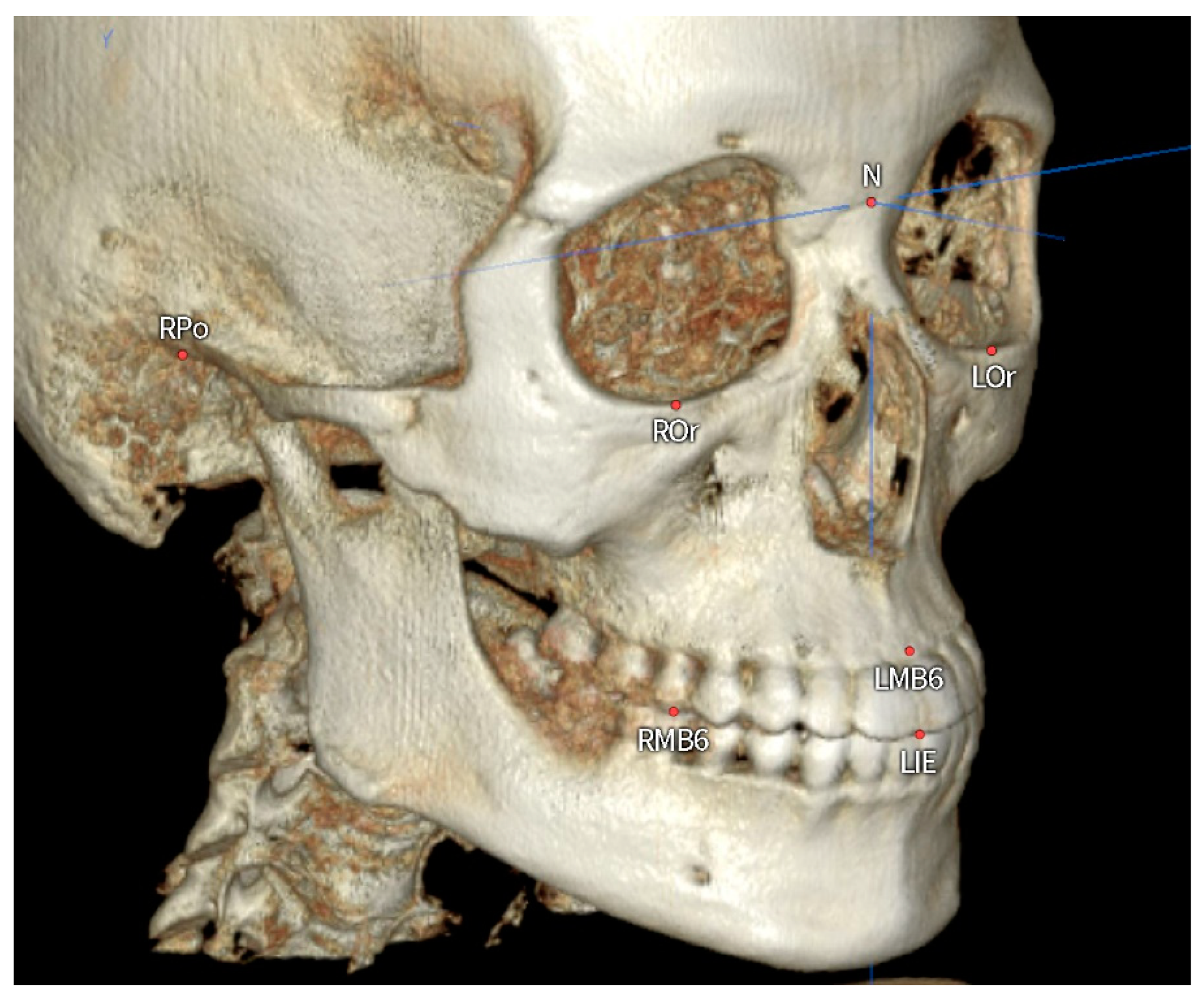 Applsci 13 03444 g001 Applsci 13 03444 g001