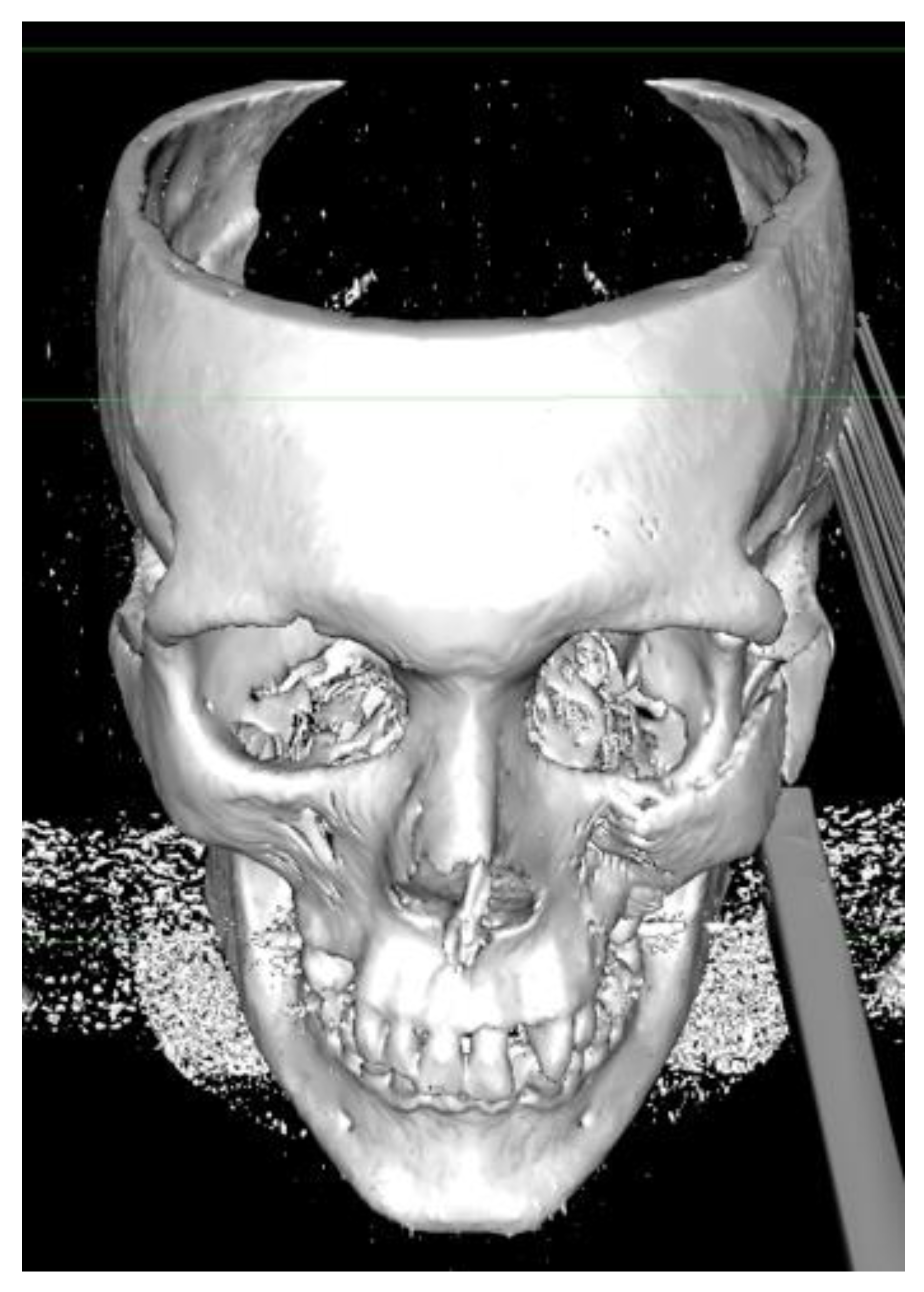 Applsci 13 03611 g004