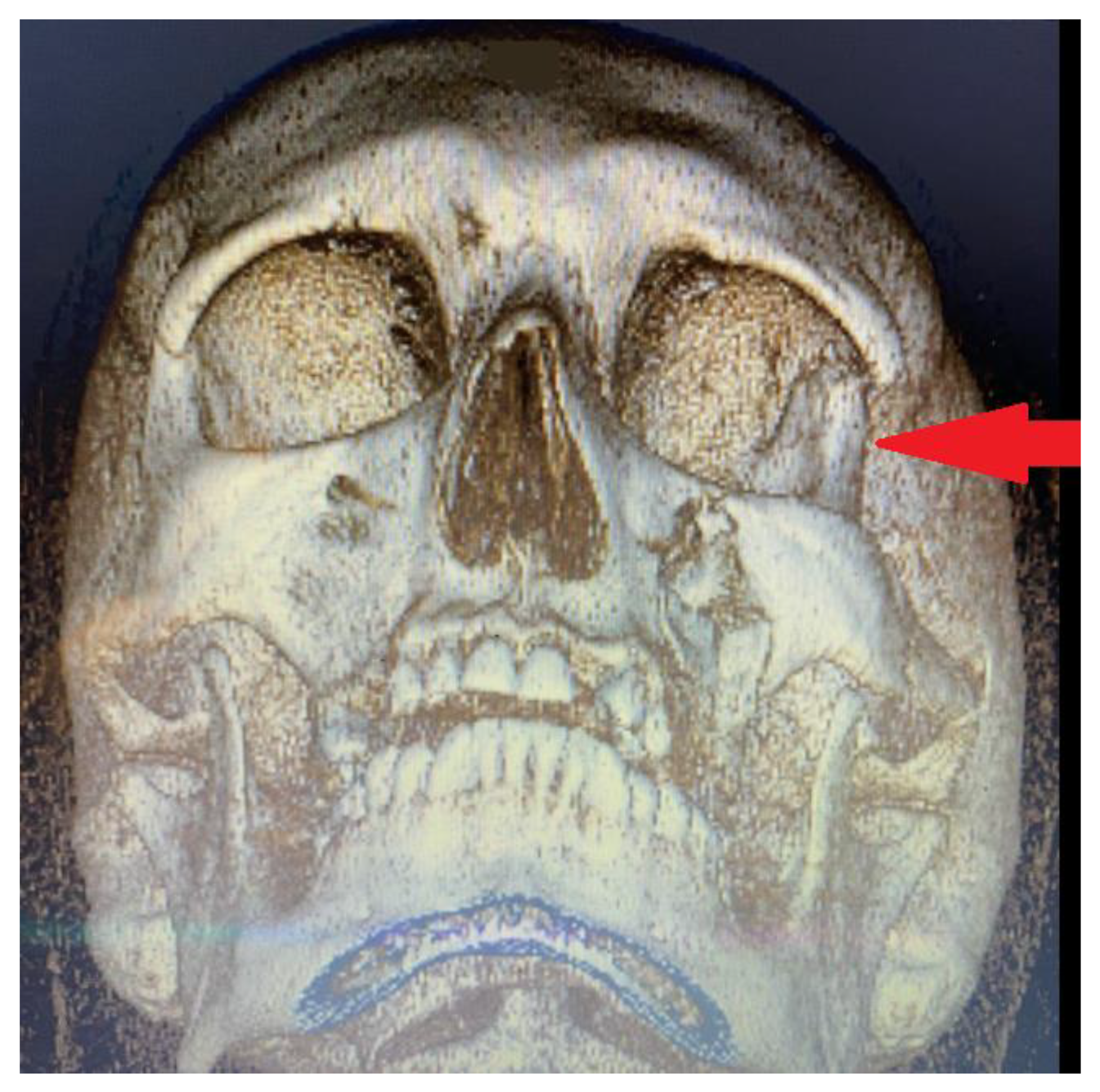 Applsci 13 03611 g006