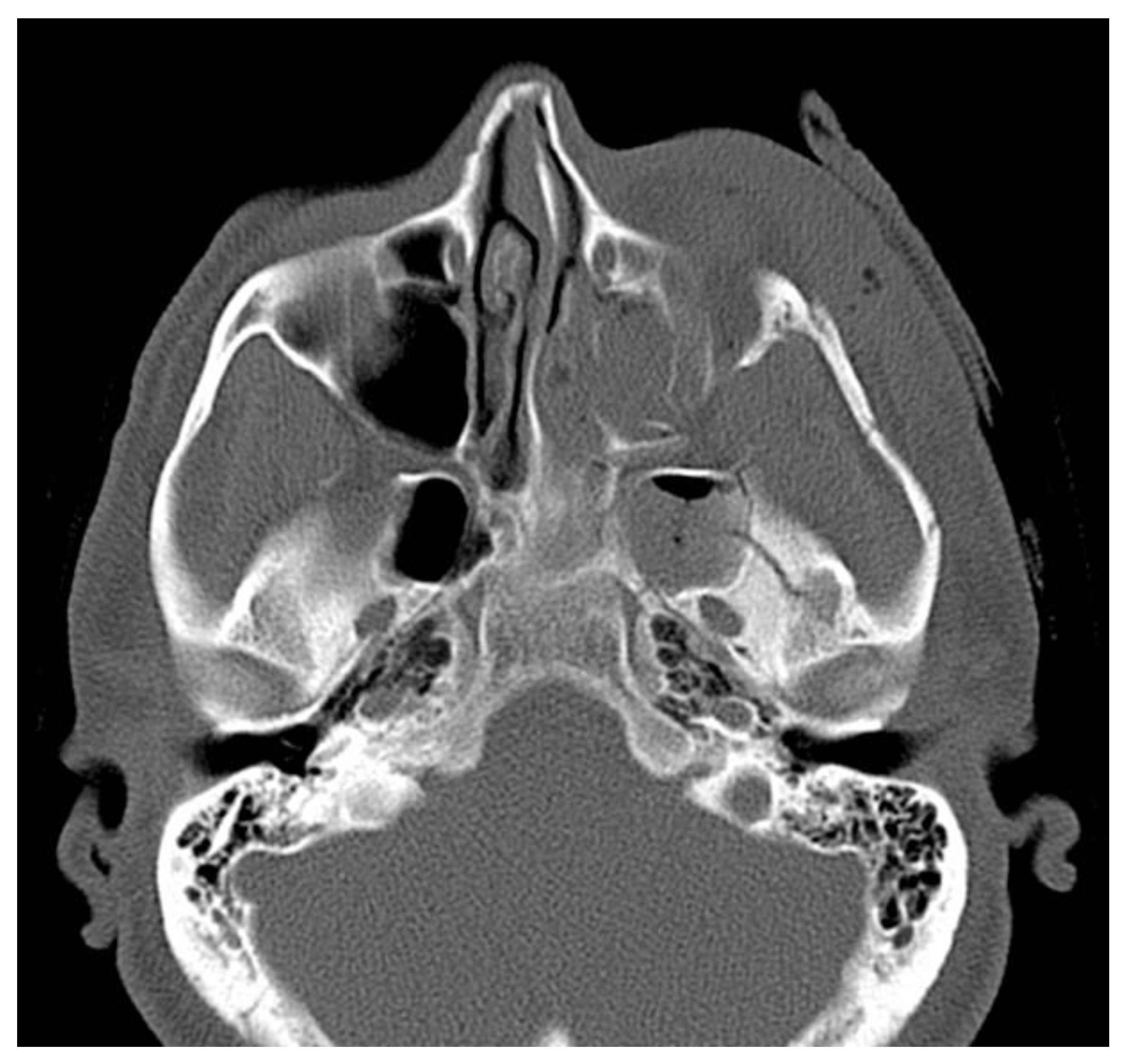 Applsci 13 03611 g007