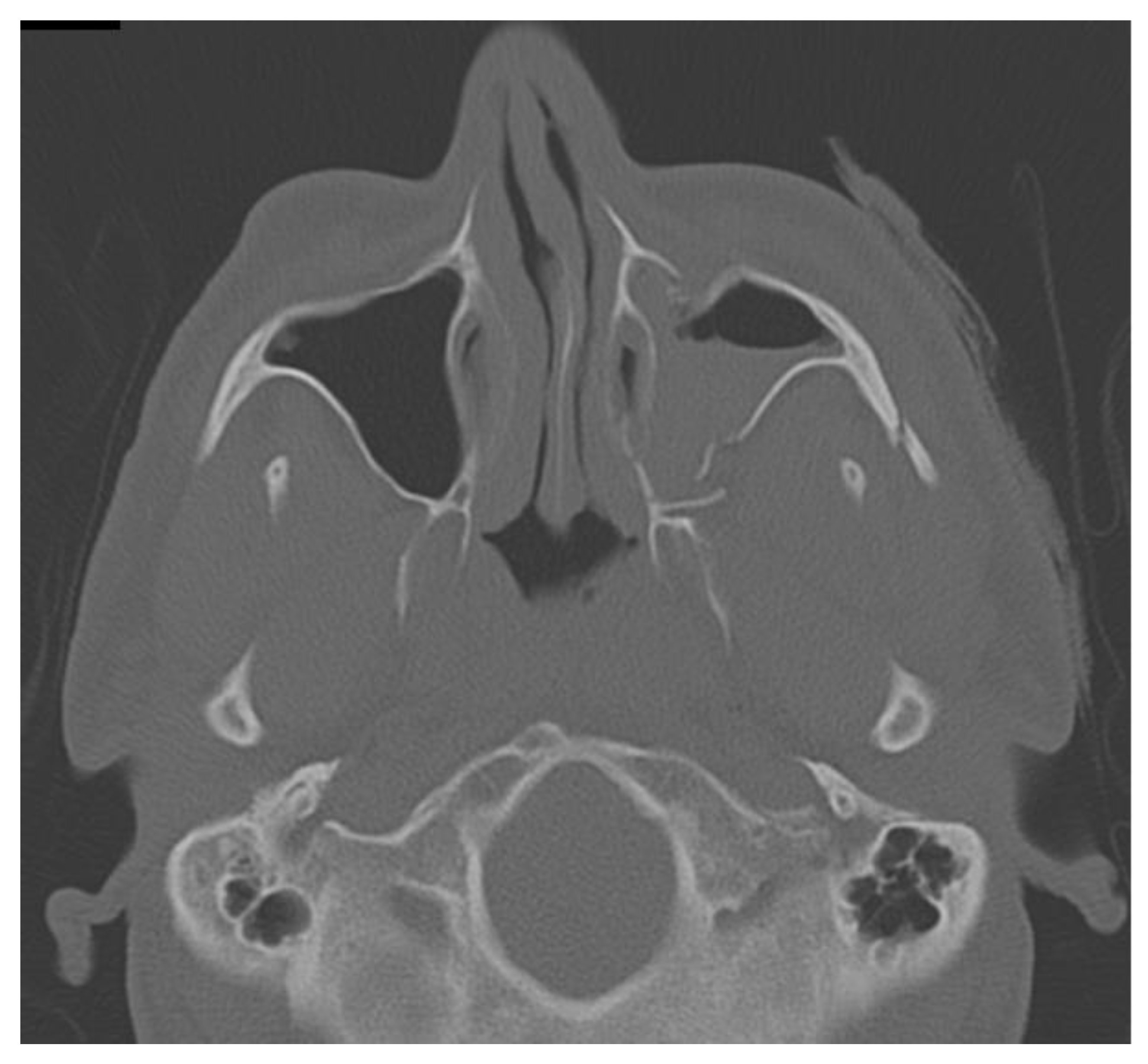 Applsci 13 03611 g008