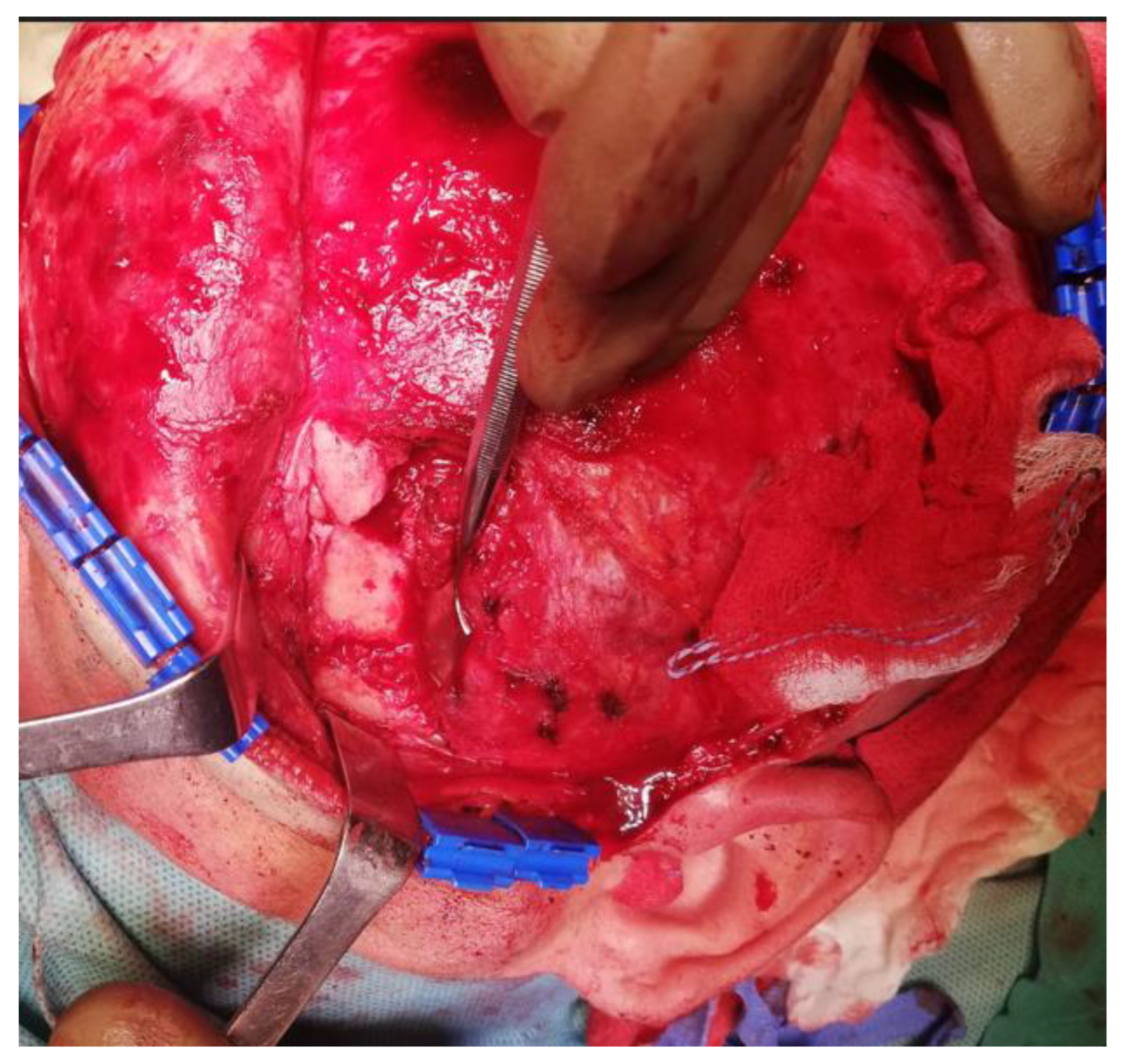 Applsci 13 03611 g011