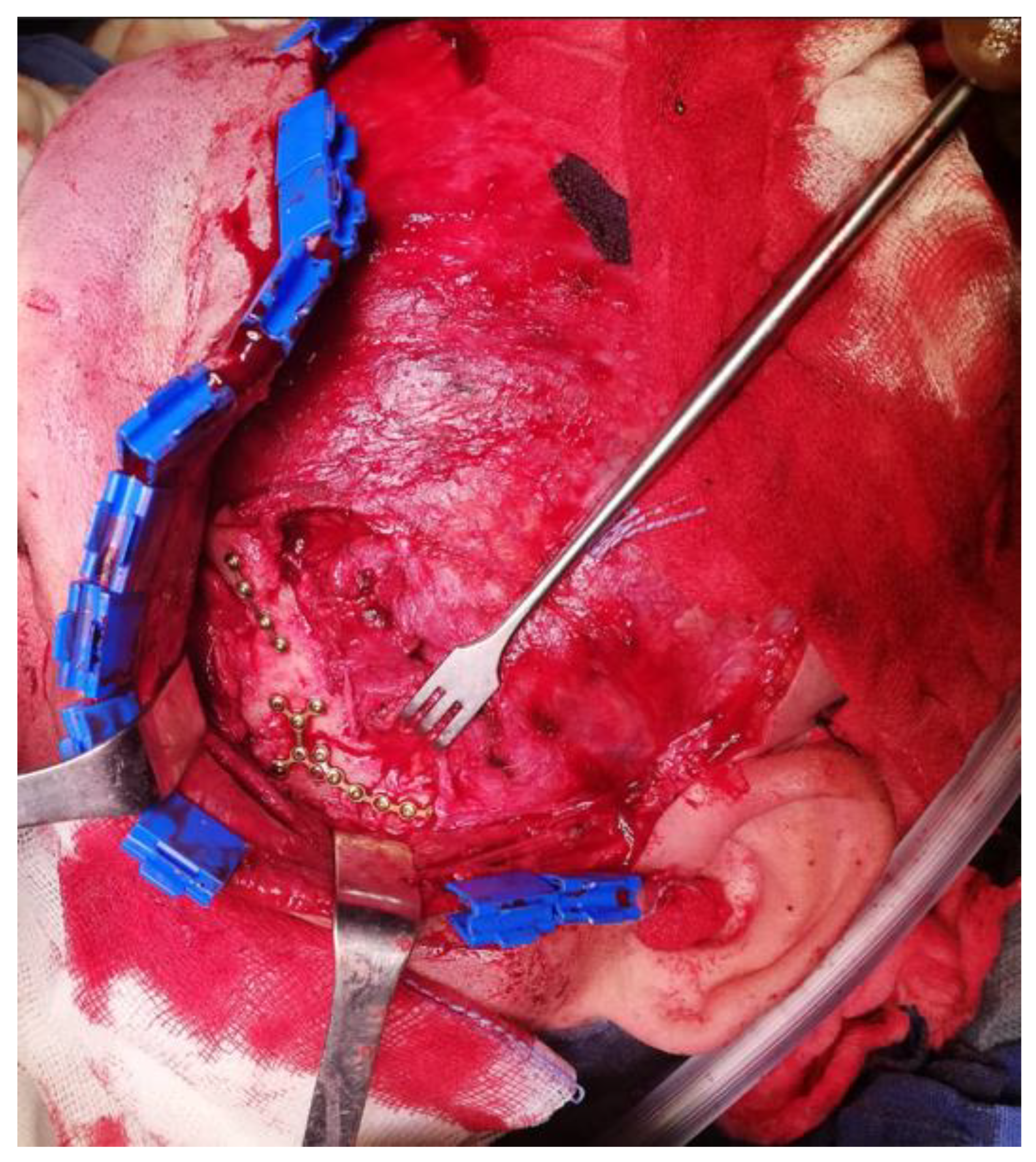 Applsci 13 03611 g012