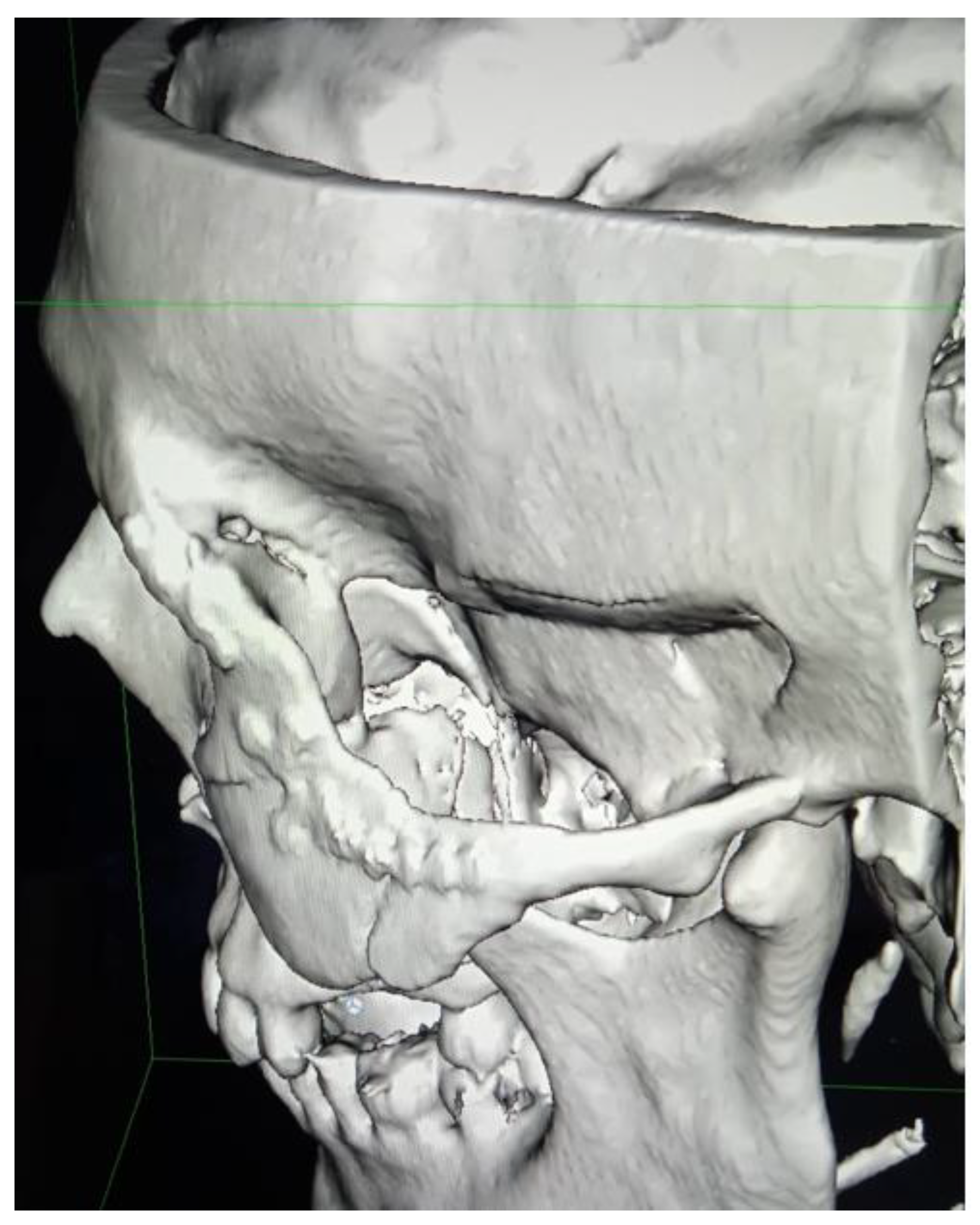 Applsci 13 03611 g013